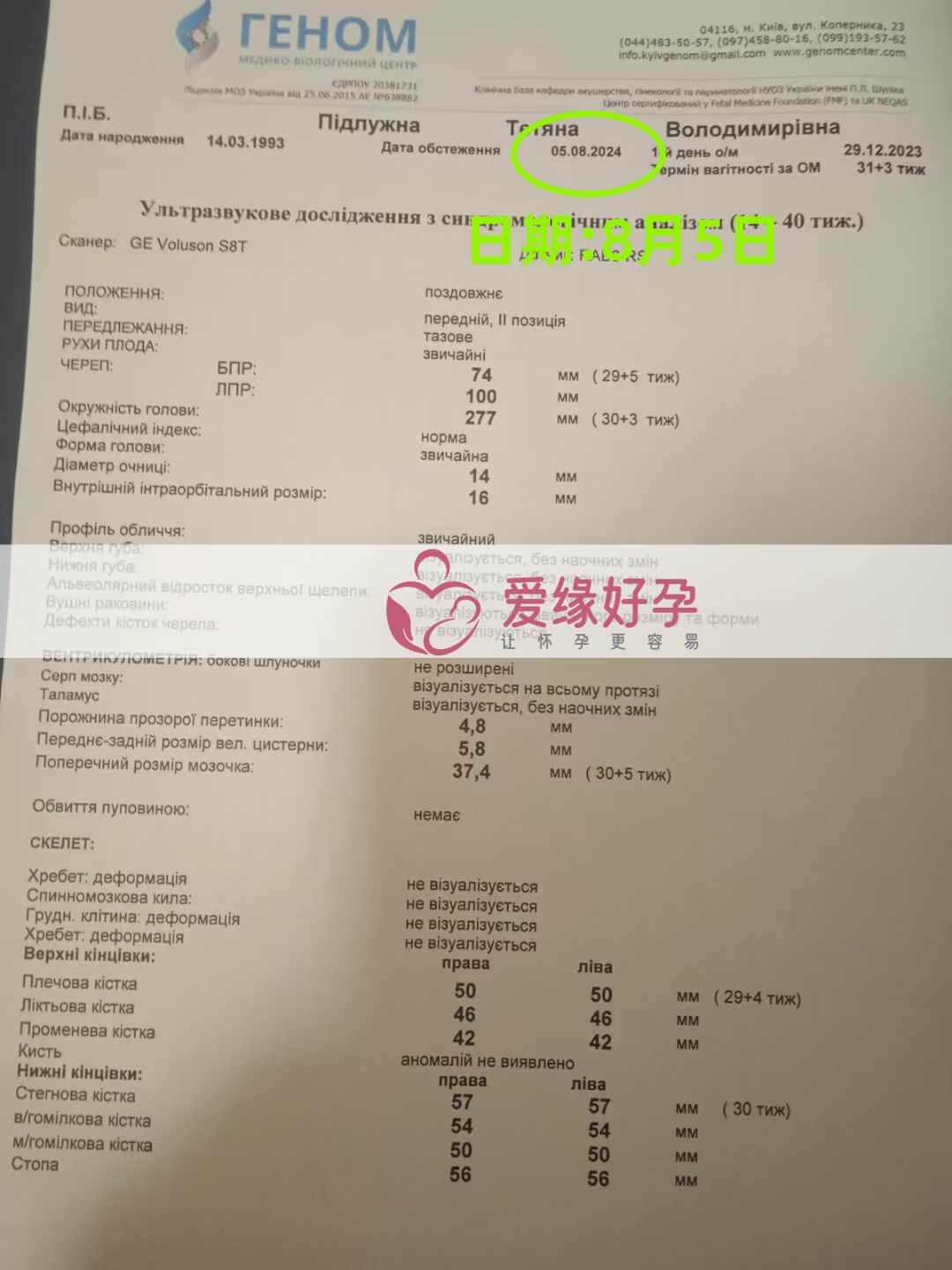 爱缘好孕乌克兰代孕代母30周孕检通过！