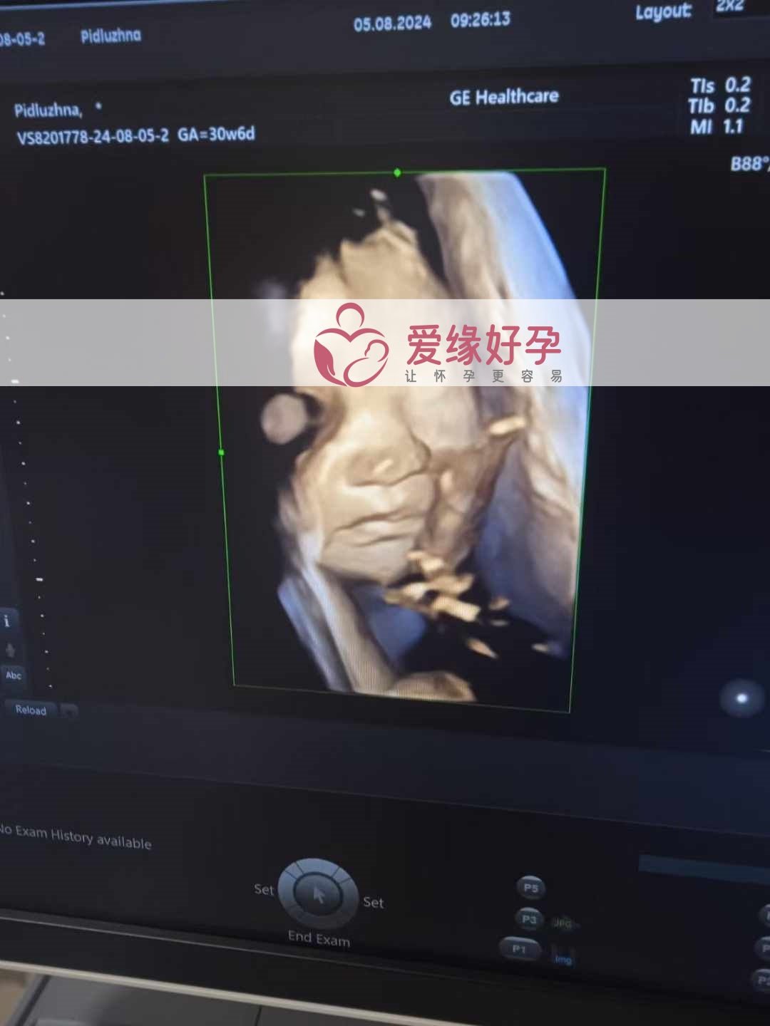 爱缘好孕乌克兰代孕代母30周孕检通过！