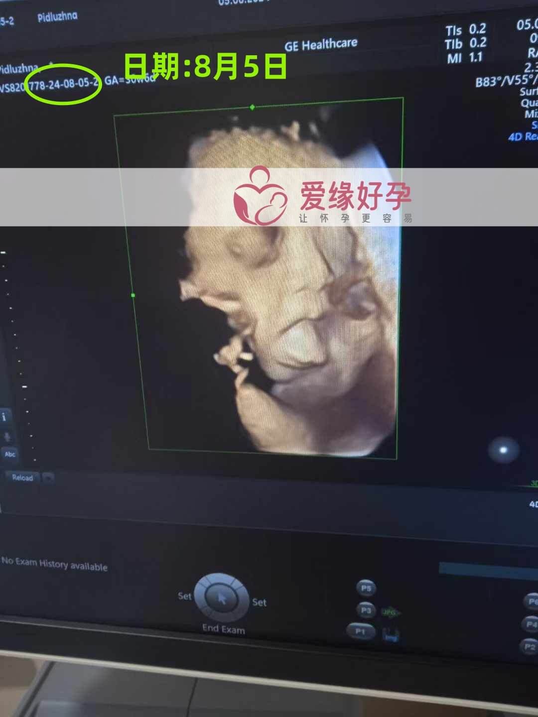 爱缘好孕乌克兰代孕代母30周孕检通过！
