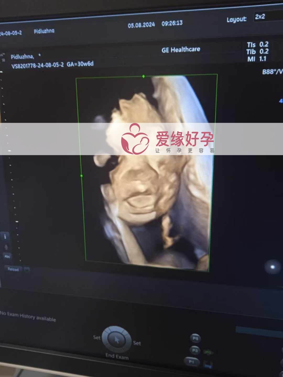 爱缘好孕乌克兰代孕代母30周孕检通过！