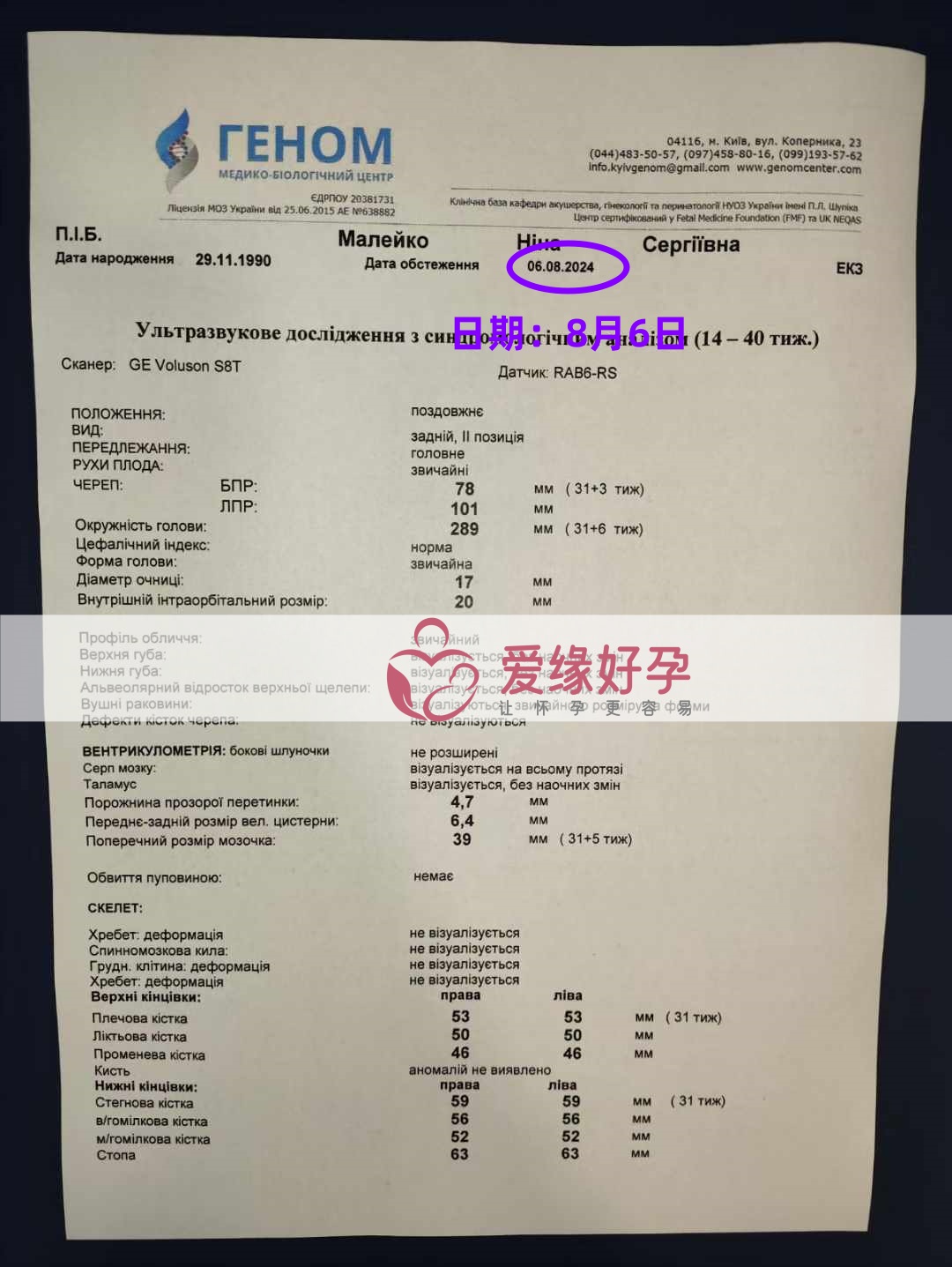 爱缘好孕乌克兰代孕代母31周孕检通过！