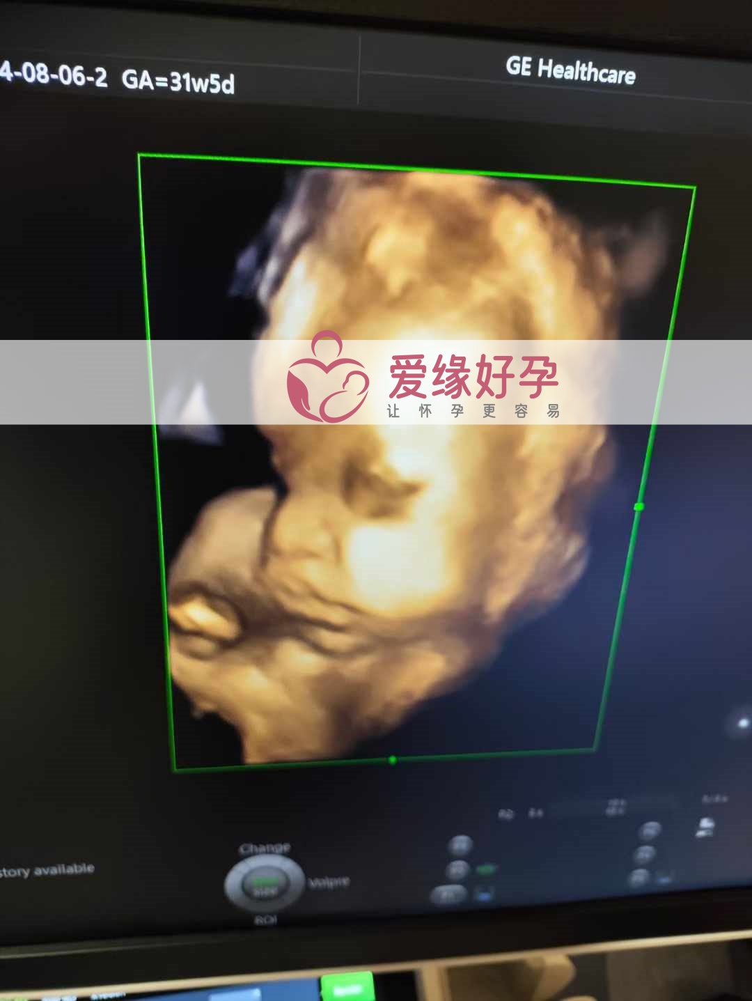 爱缘好孕乌克兰代孕代母31周孕检通过！