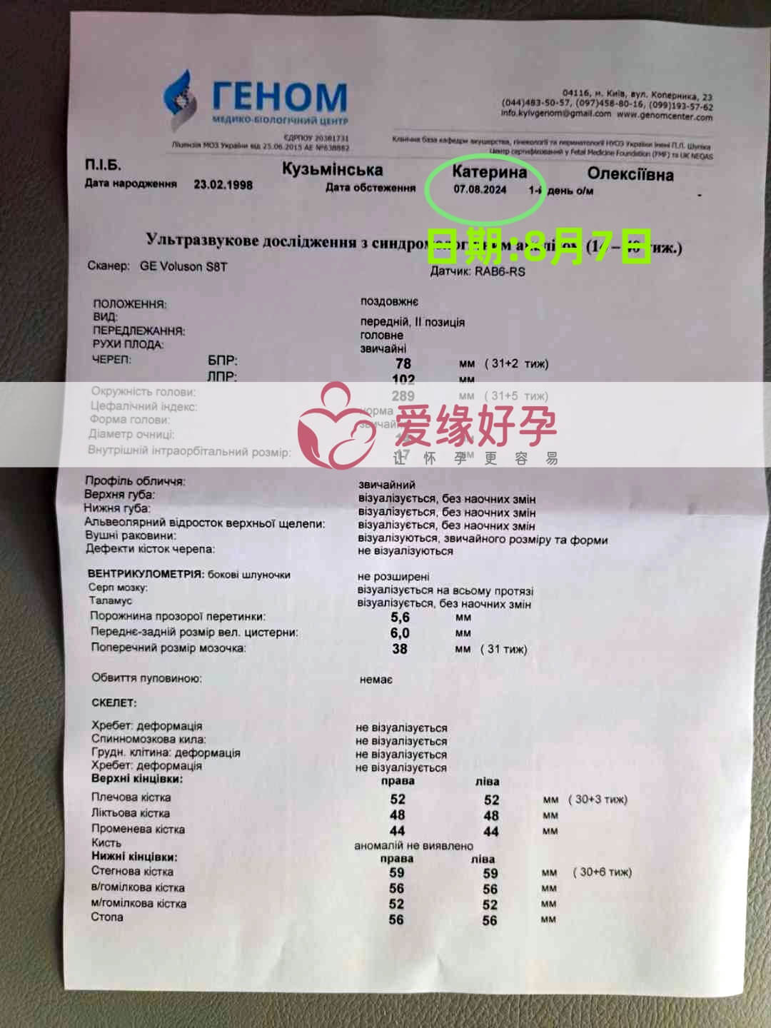 爱缘好孕乌克兰代孕代母30周孕检通过！