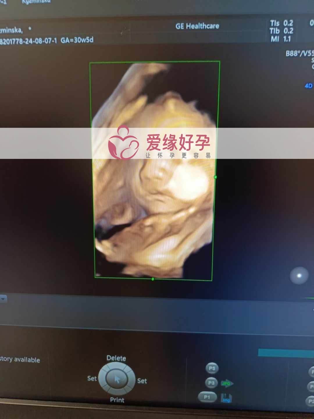 爱缘好孕乌克兰代孕代母30周孕检通过！