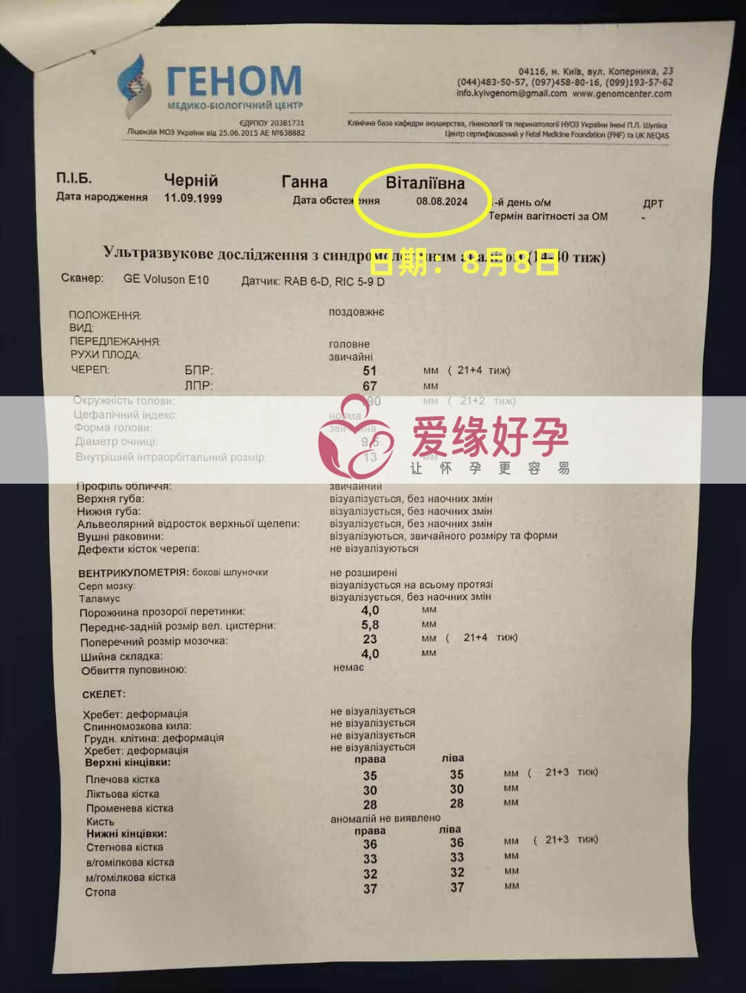 爱缘好孕乌克兰代孕代母21周孕检通过！
