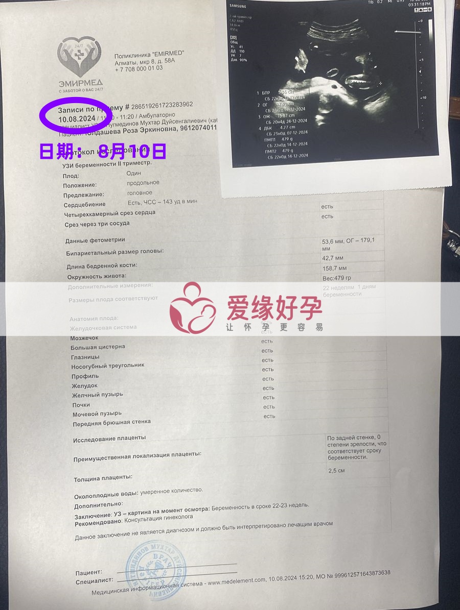 爱缘好孕哈萨克斯坦Z女士夫妇的自卵宝宝22周产检通过！
