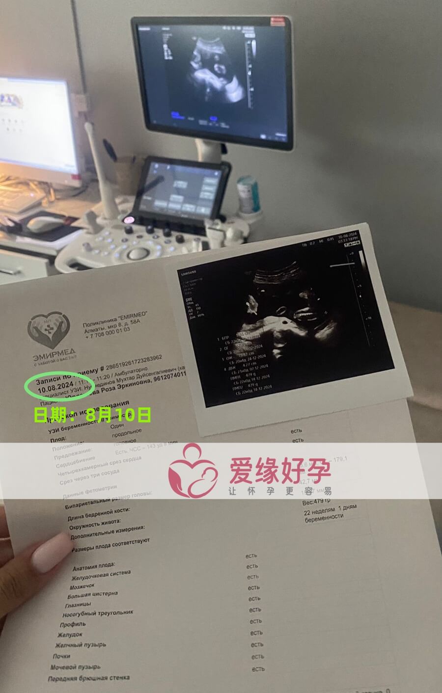 爱缘好孕哈萨克斯坦Z女士夫妇的自卵宝宝22周产检通过！