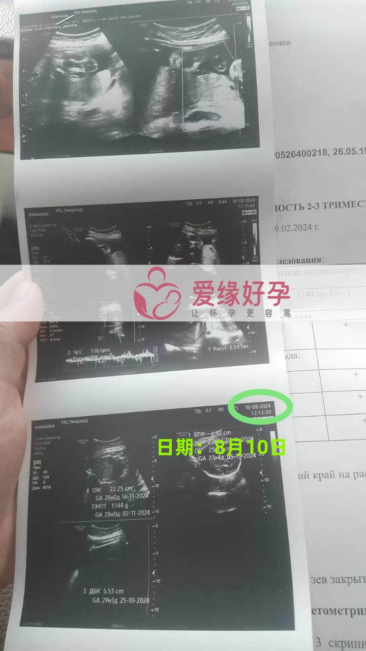 爱缘好孕哈萨克斯坦代孕代母28周孕检通过！