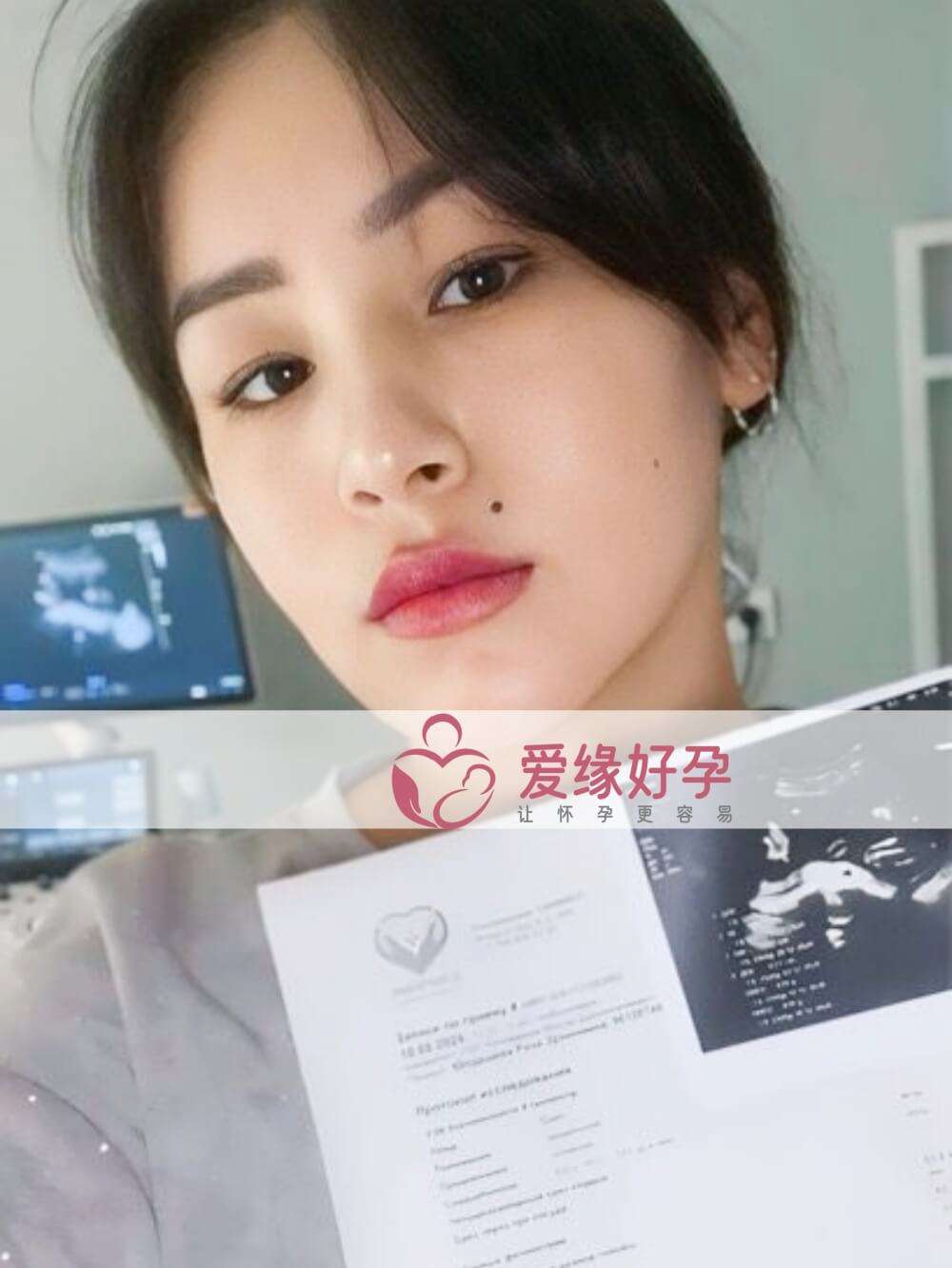 爱缘好孕哈萨克斯坦Z女士夫妇的自卵宝宝22周产检通过！