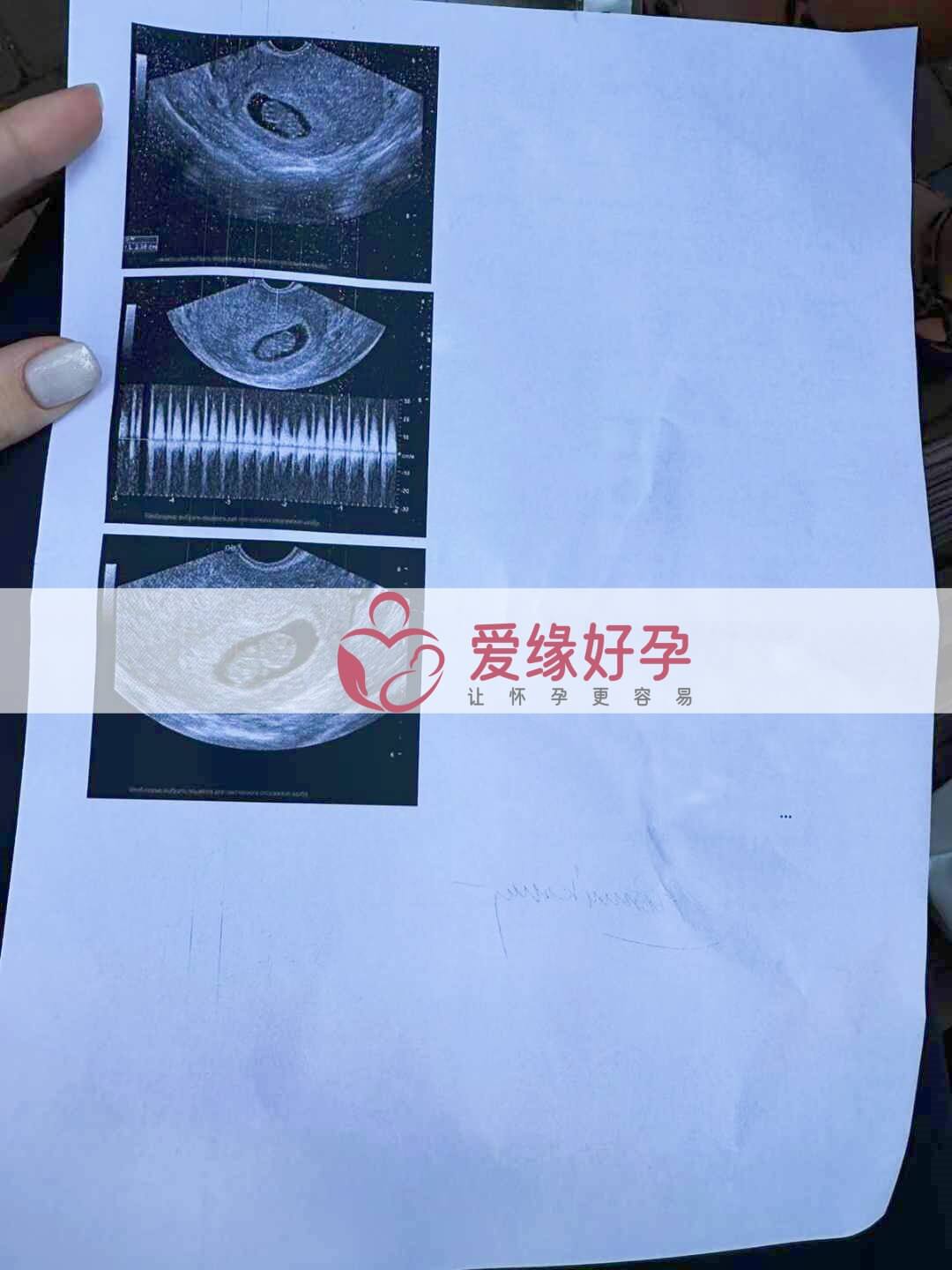 爱缘好孕乌克兰代孕代母孕8周产检顺利通过！