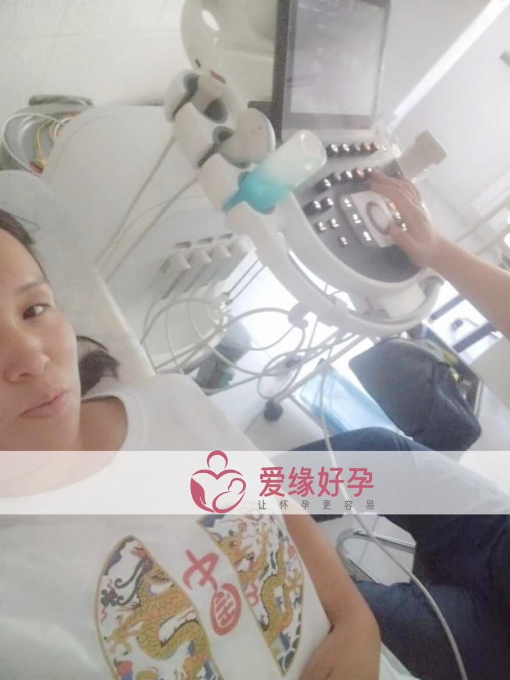 爱缘好孕哈萨克斯坦代孕代母B超产检通过！