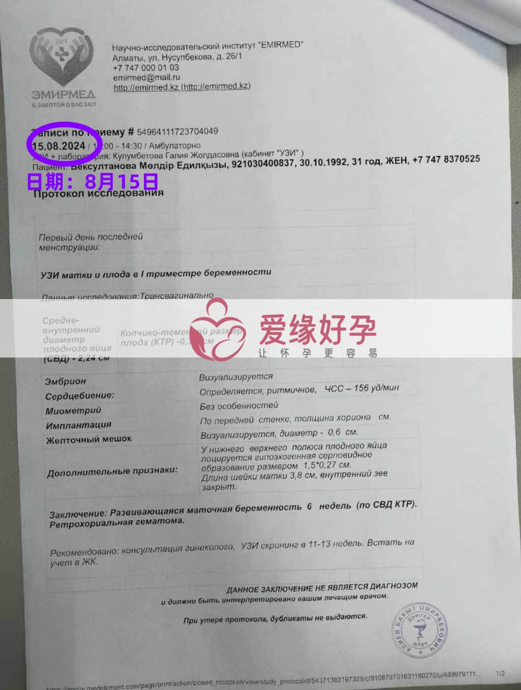 爱缘好孕哈萨克斯坦代孕代母B超产检通过！