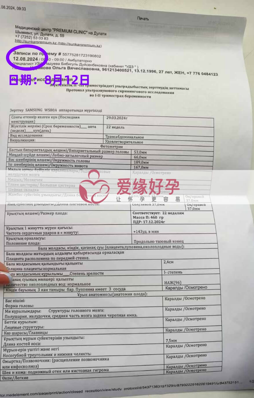 爱缘好孕哈萨克斯坦代孕代母22周产检顺利通过！