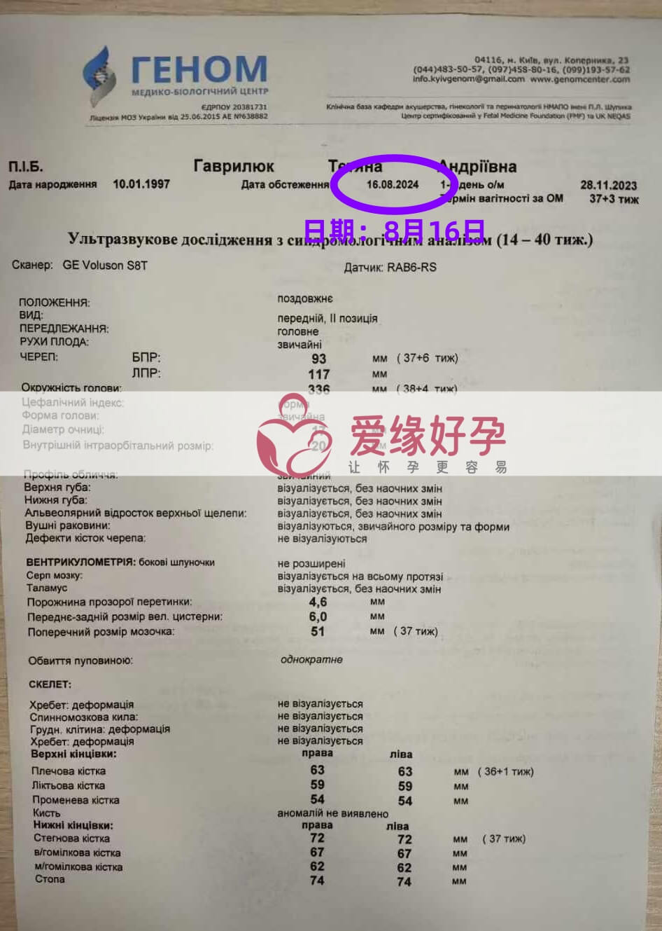 爱缘好孕乌克兰代孕代母孕37周产检顺利通过！
