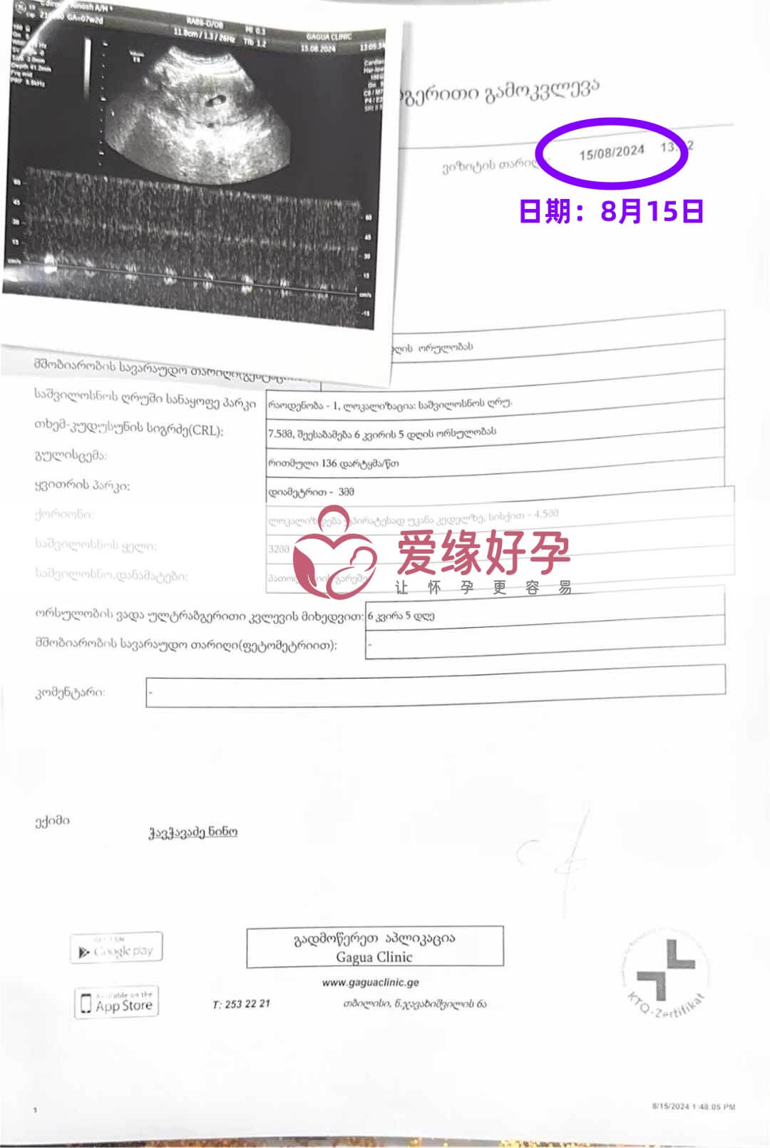 爱缘好孕格鲁吉亚代孕代母B超产检通过！