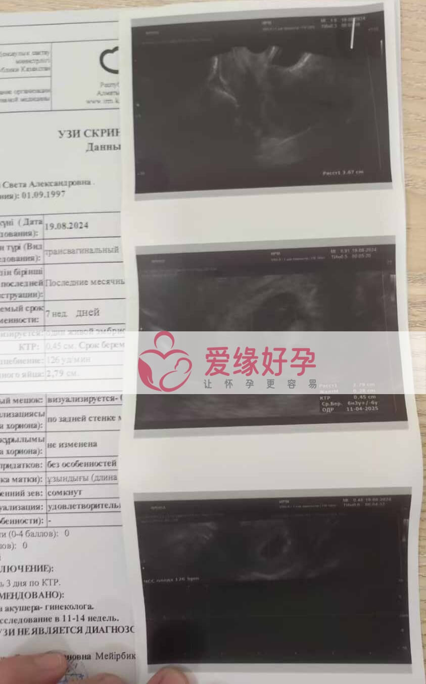 爱缘好孕哈萨克斯坦代孕代母孕6周产检顺利通过！