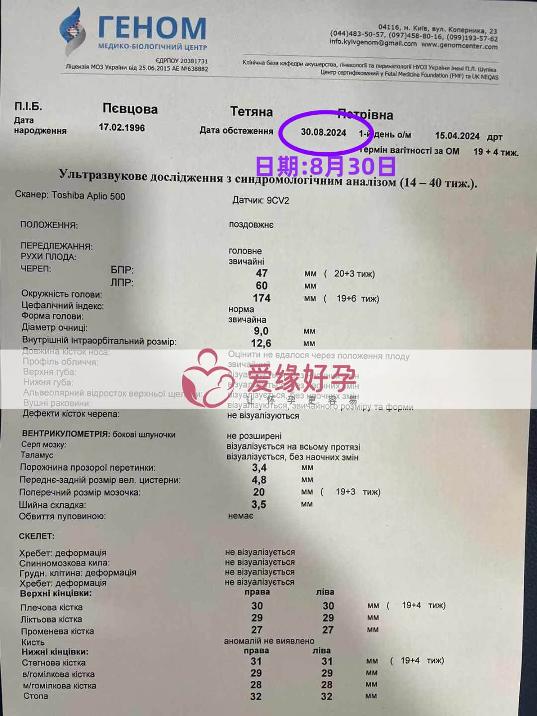 乌克兰恩泽ENZE代孕代母孕20周产检顺利通过！