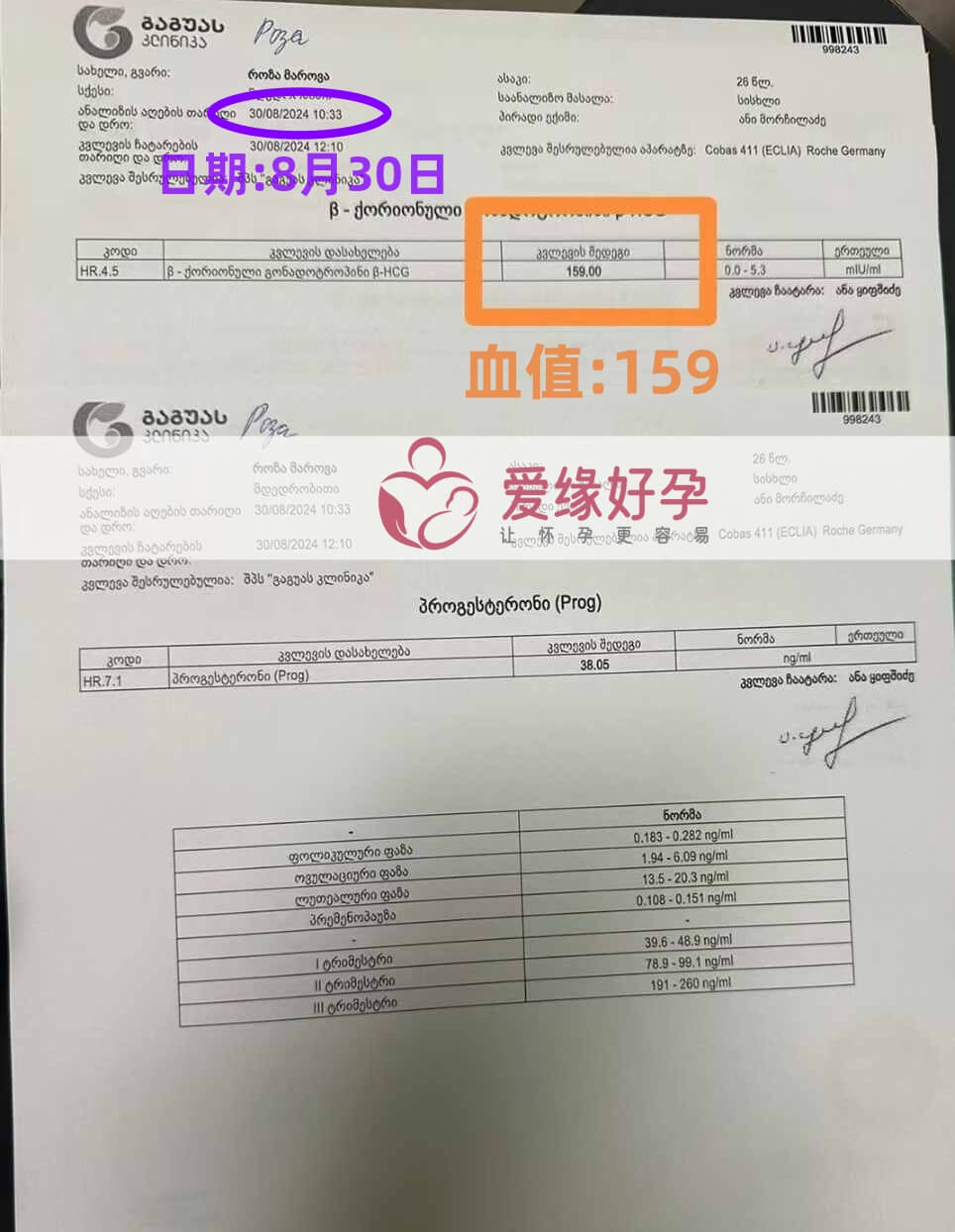 格鲁吉亚恩泽ENZE代孕代母验孕着床成功！