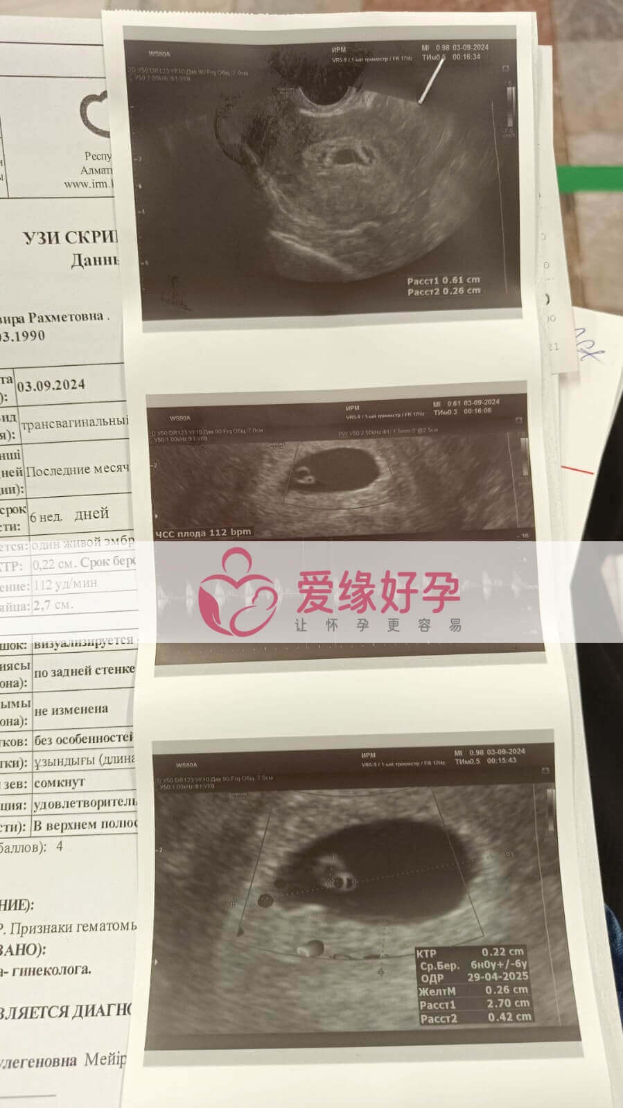 哈萨克斯坦恩泽代孕代母孕6周产检顺利通过!