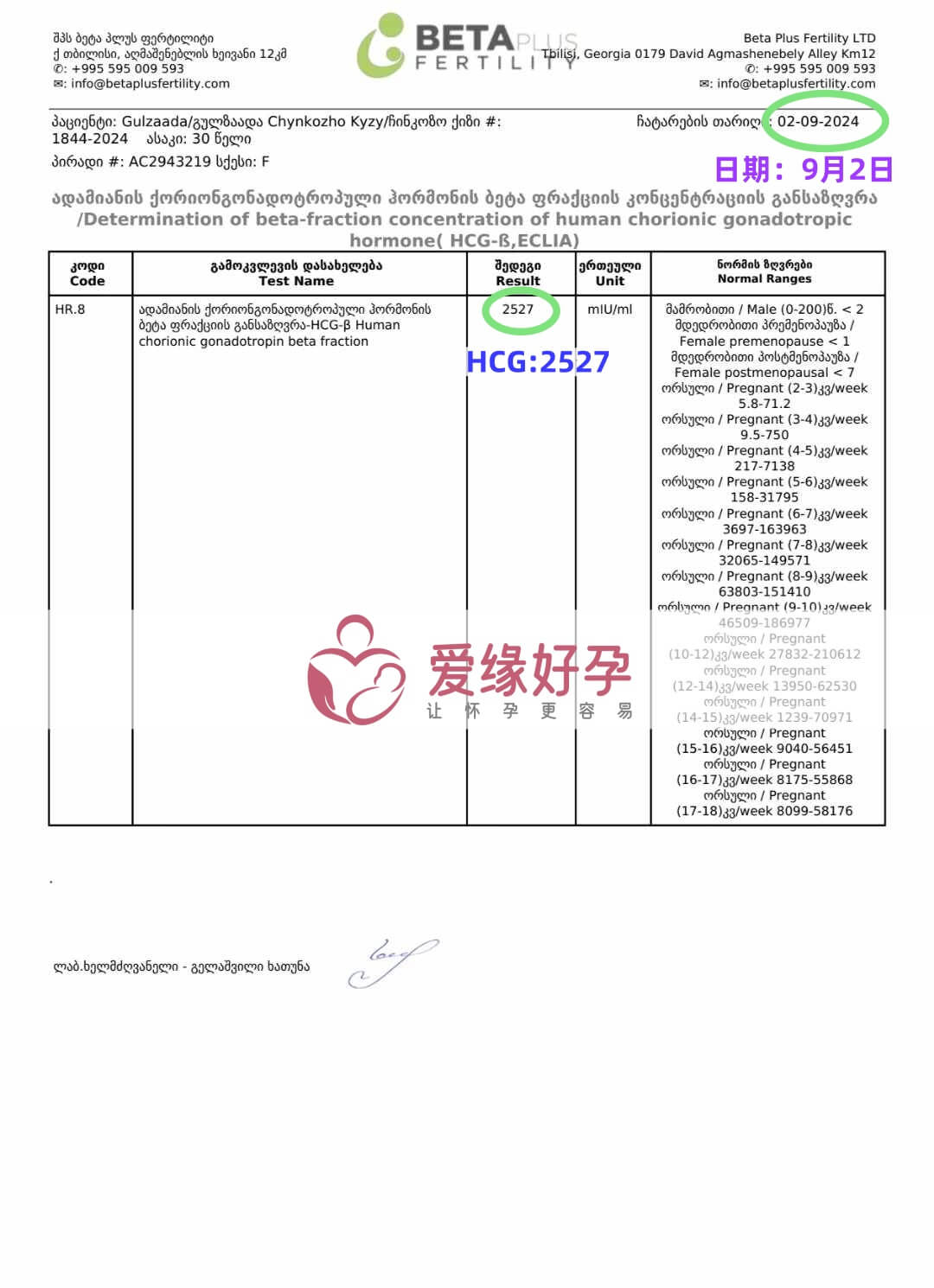 格鲁吉亚恩泽代孕代母验孕着床成功！