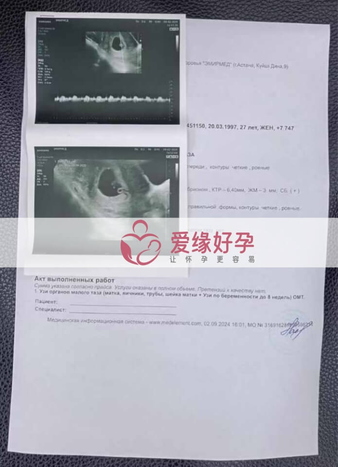 哈萨克斯坦恩泽代孕代母第一次B超产检！