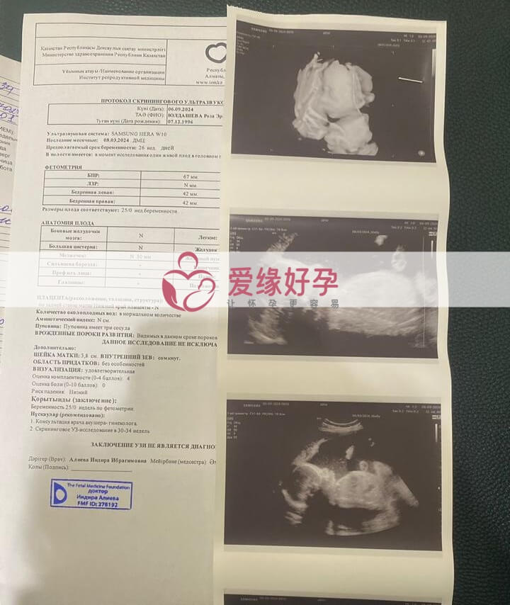 哈萨克斯坦恩泽代孕代母孕25周产检！