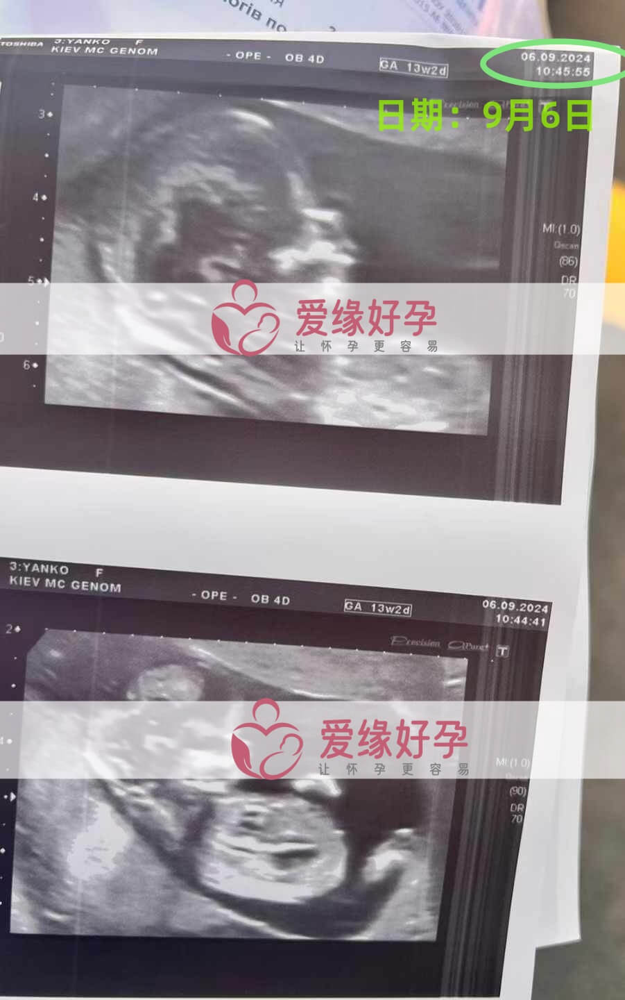 乌克兰恩泽代孕代母孕13周产检顺利通过！