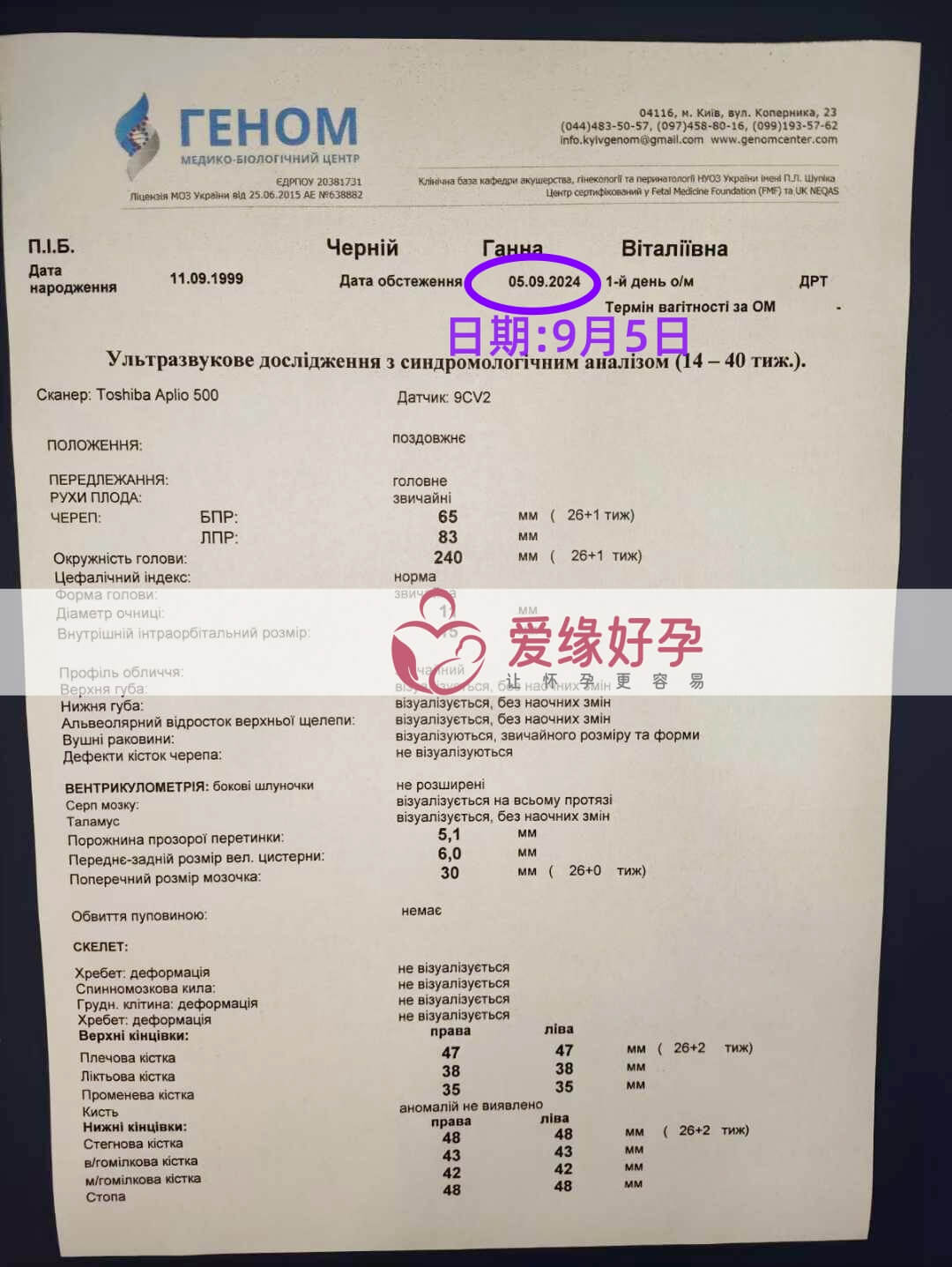 乌克兰恩泽代孕代母孕26周产检顺利通过！