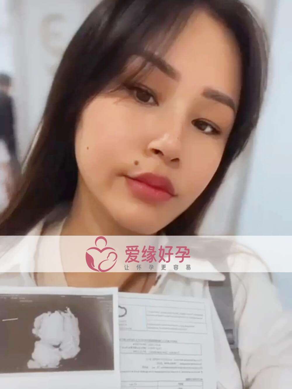 哈萨克斯坦恩泽代孕代母孕25周产检！