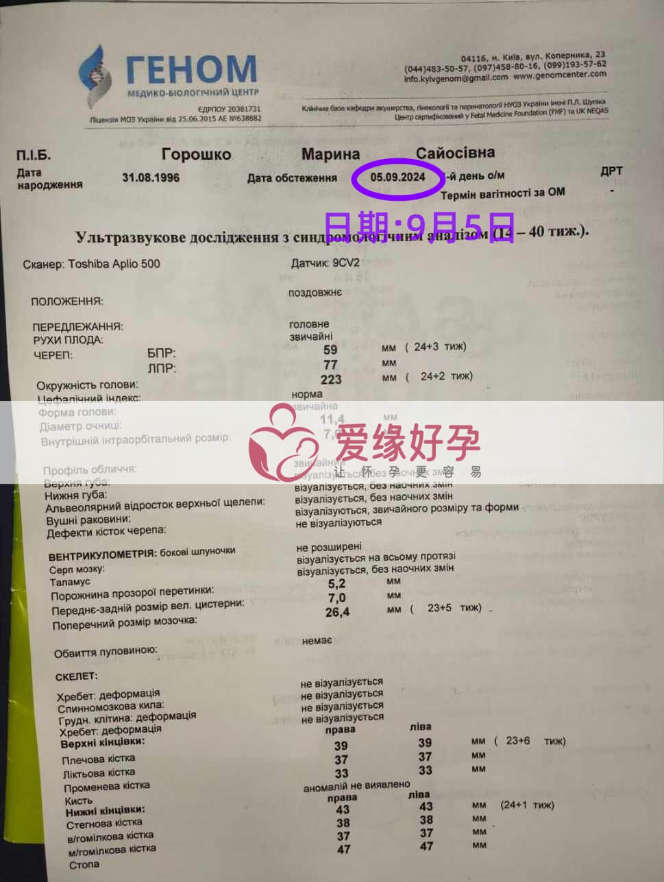 乌克兰恩泽代孕代母孕24周产检顺利通过