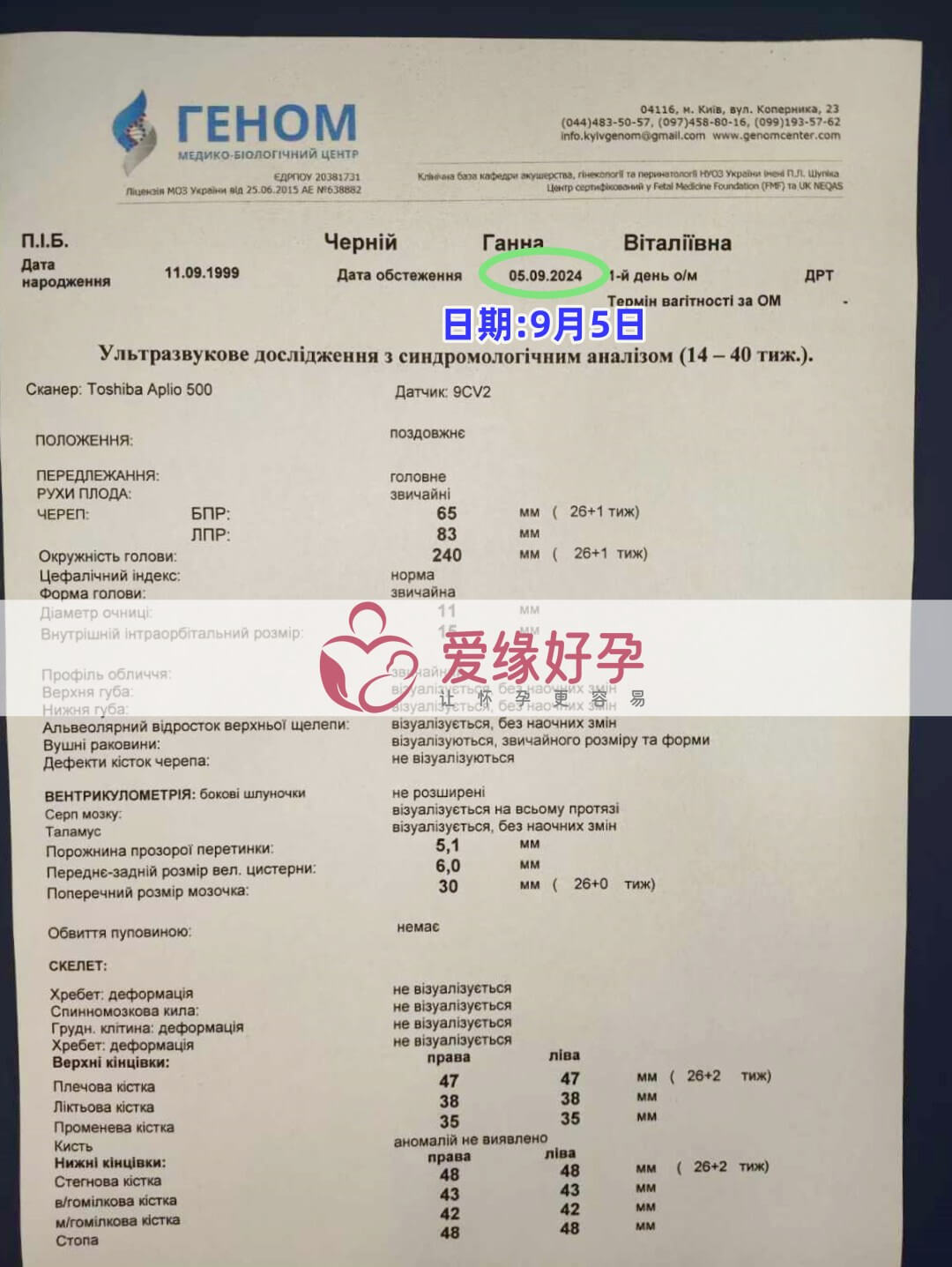 乌克兰恩泽代孕代母孕26周产检顺利通过