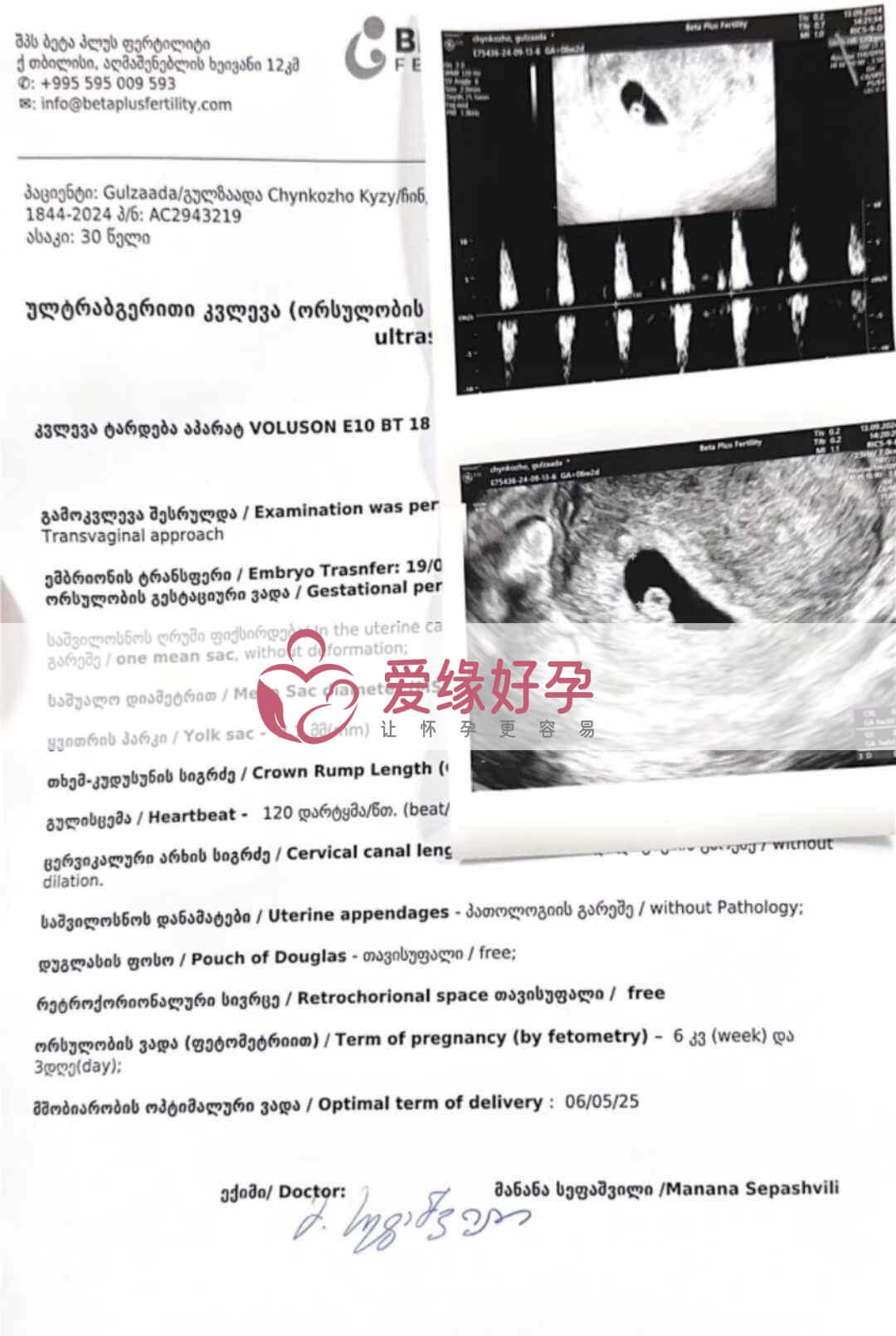 格鲁吉亚代孕代母孕6周产检顺利通过