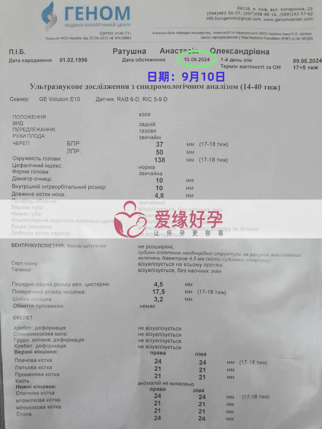 乌克兰代孕代母孕17周产检顺利通过