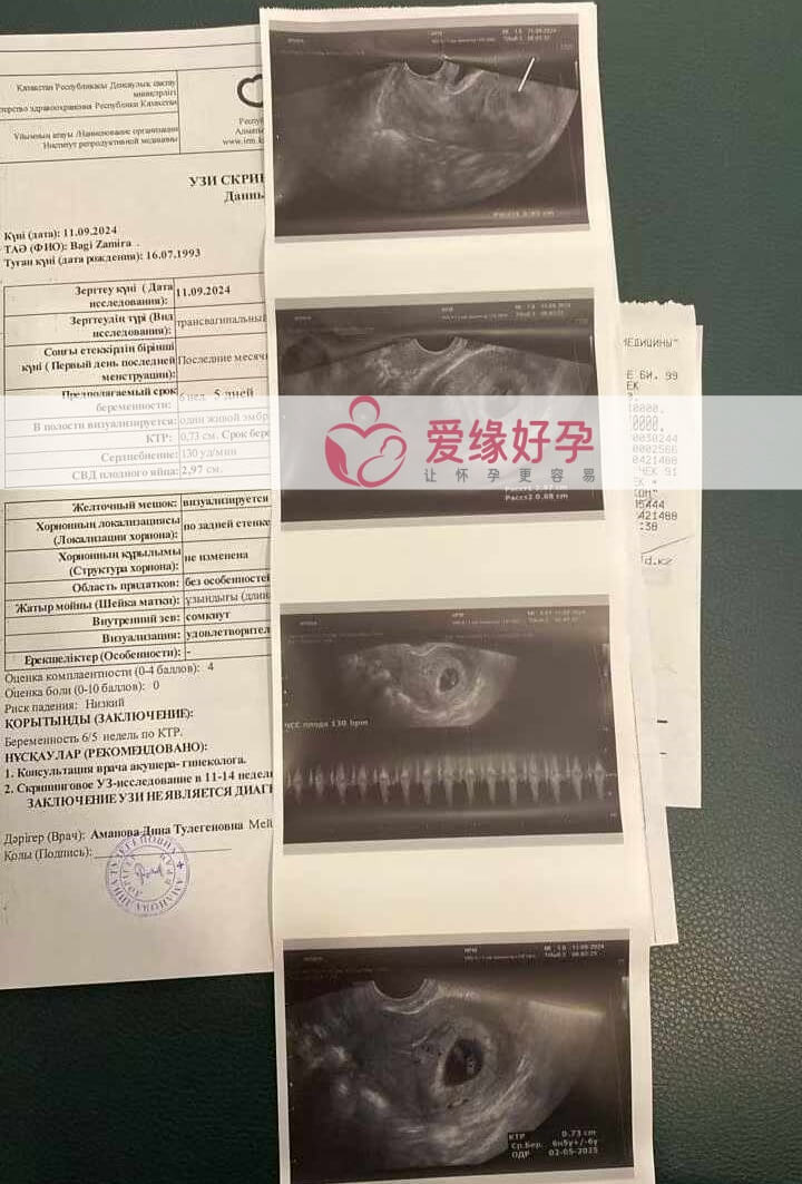 哈萨克斯坦代孕代母第一次B超产检