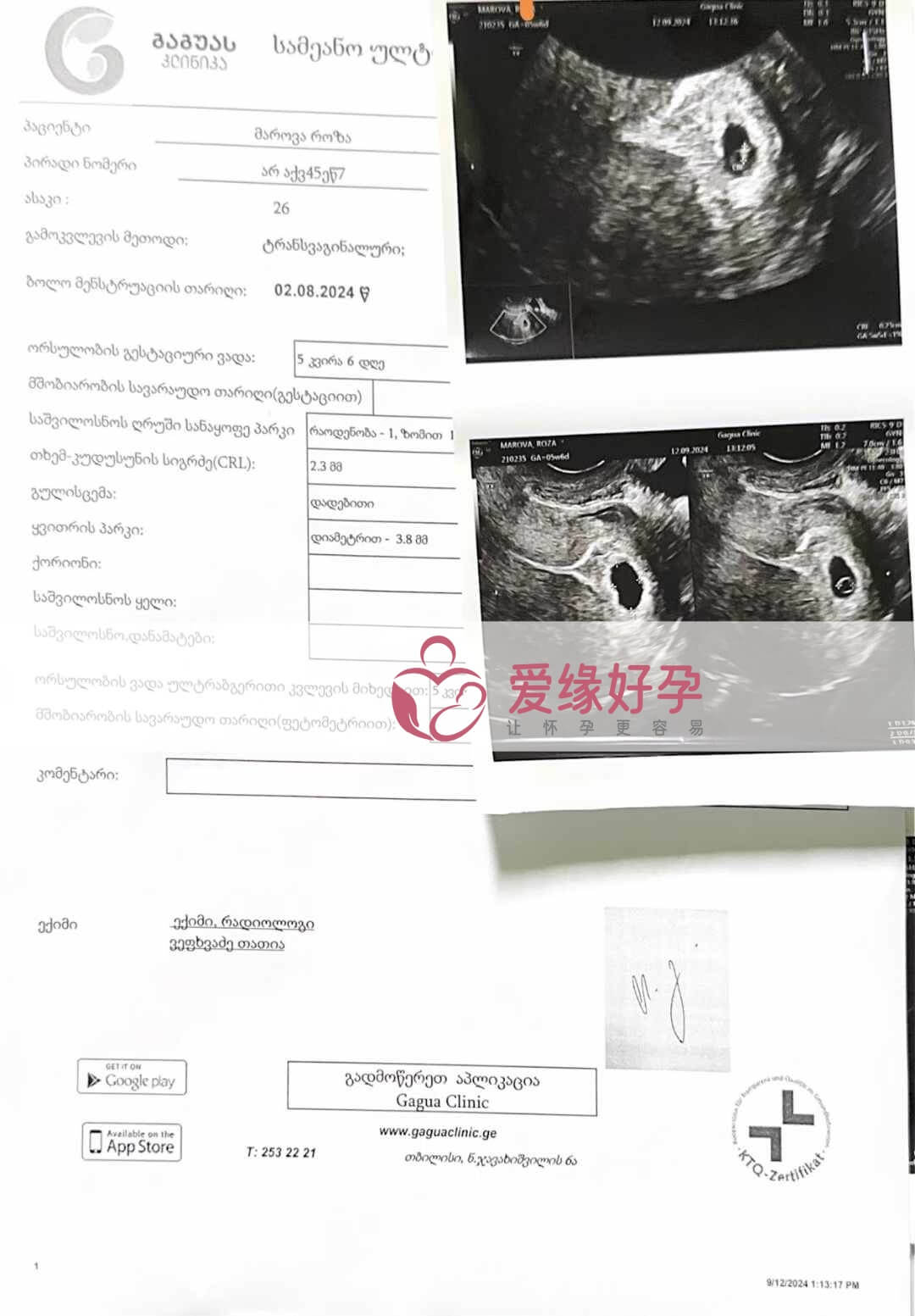 格鲁吉亚代孕代母第一次B超产检