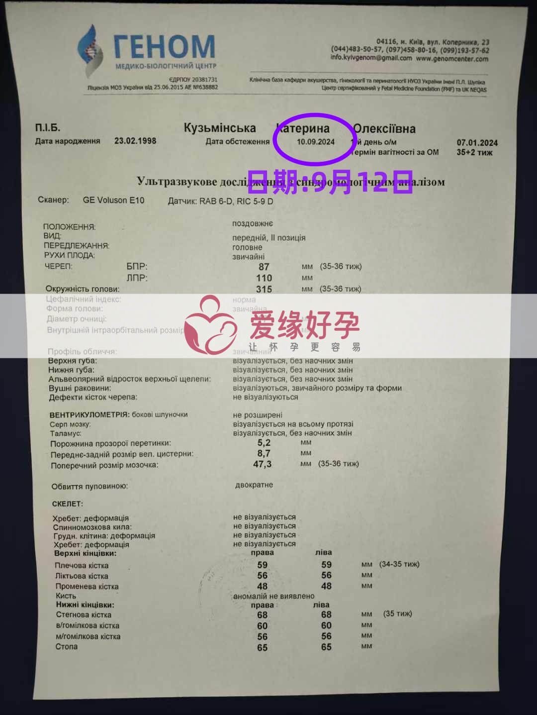 乌克兰代孕代母孕35周产检顺利通过