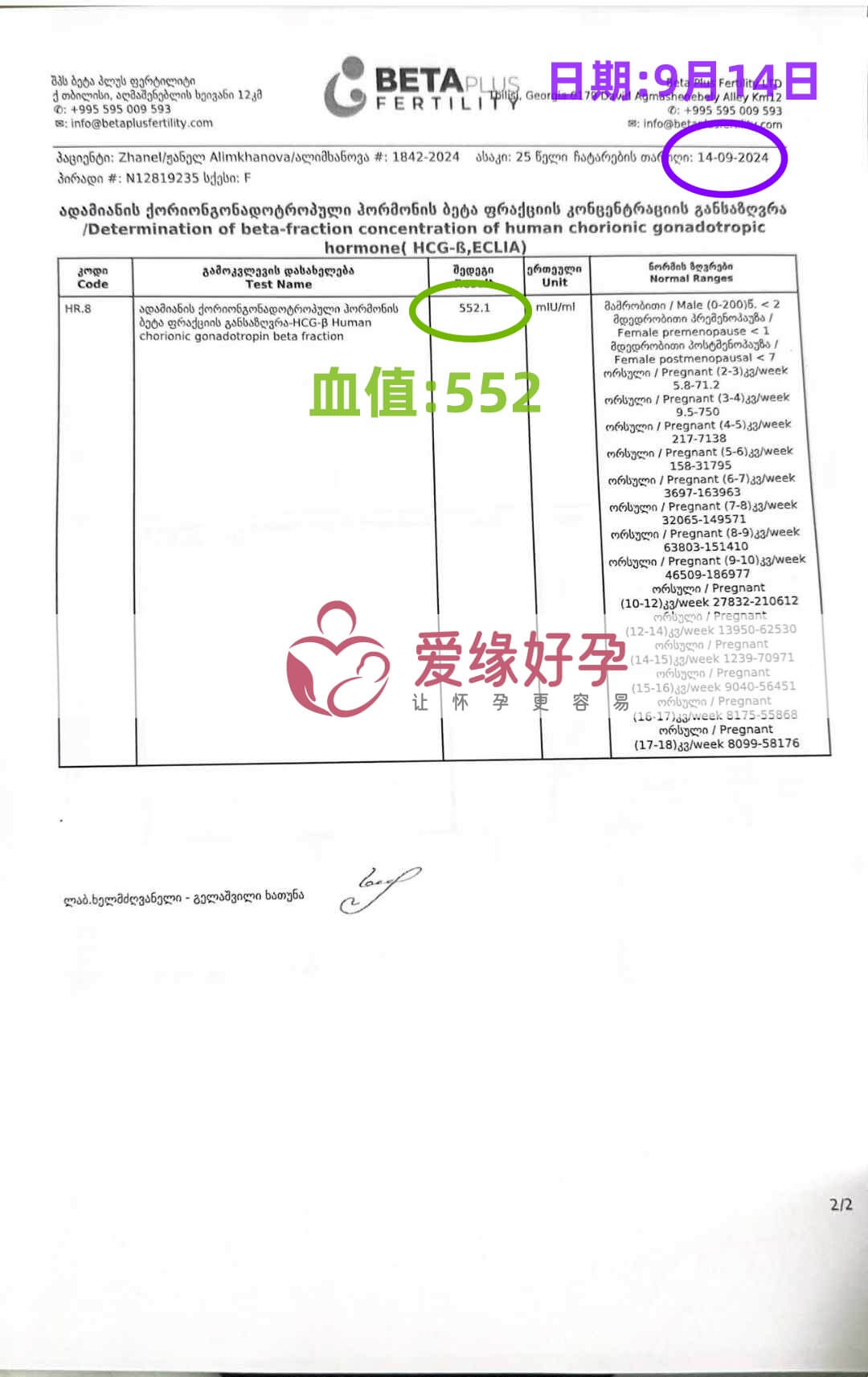 格鲁吉亚代孕代母验孕着床成功