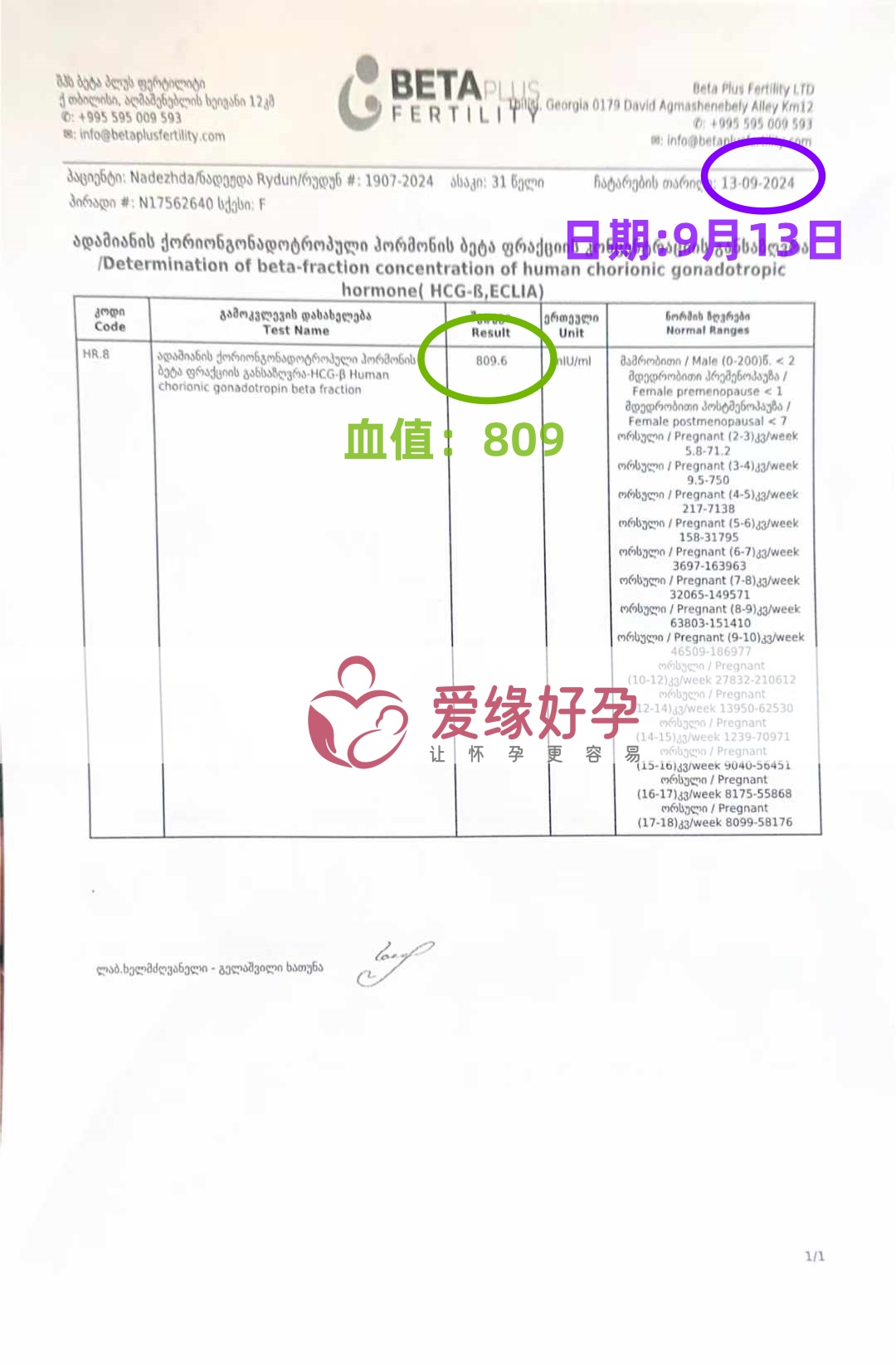 格鲁吉亚代孕代母验孕着床成功