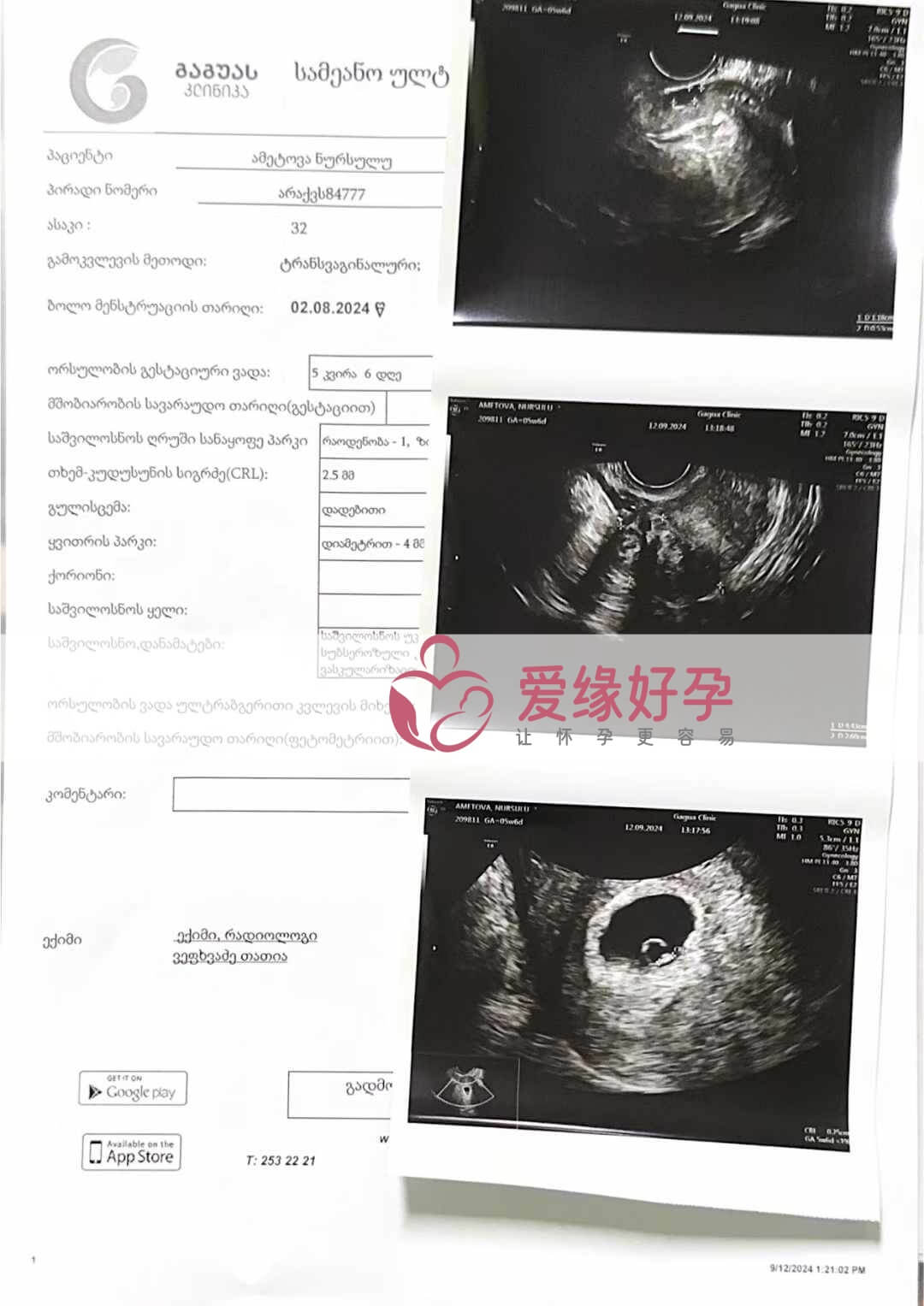 格鲁吉亚代孕代母孕5周产检顺利通过