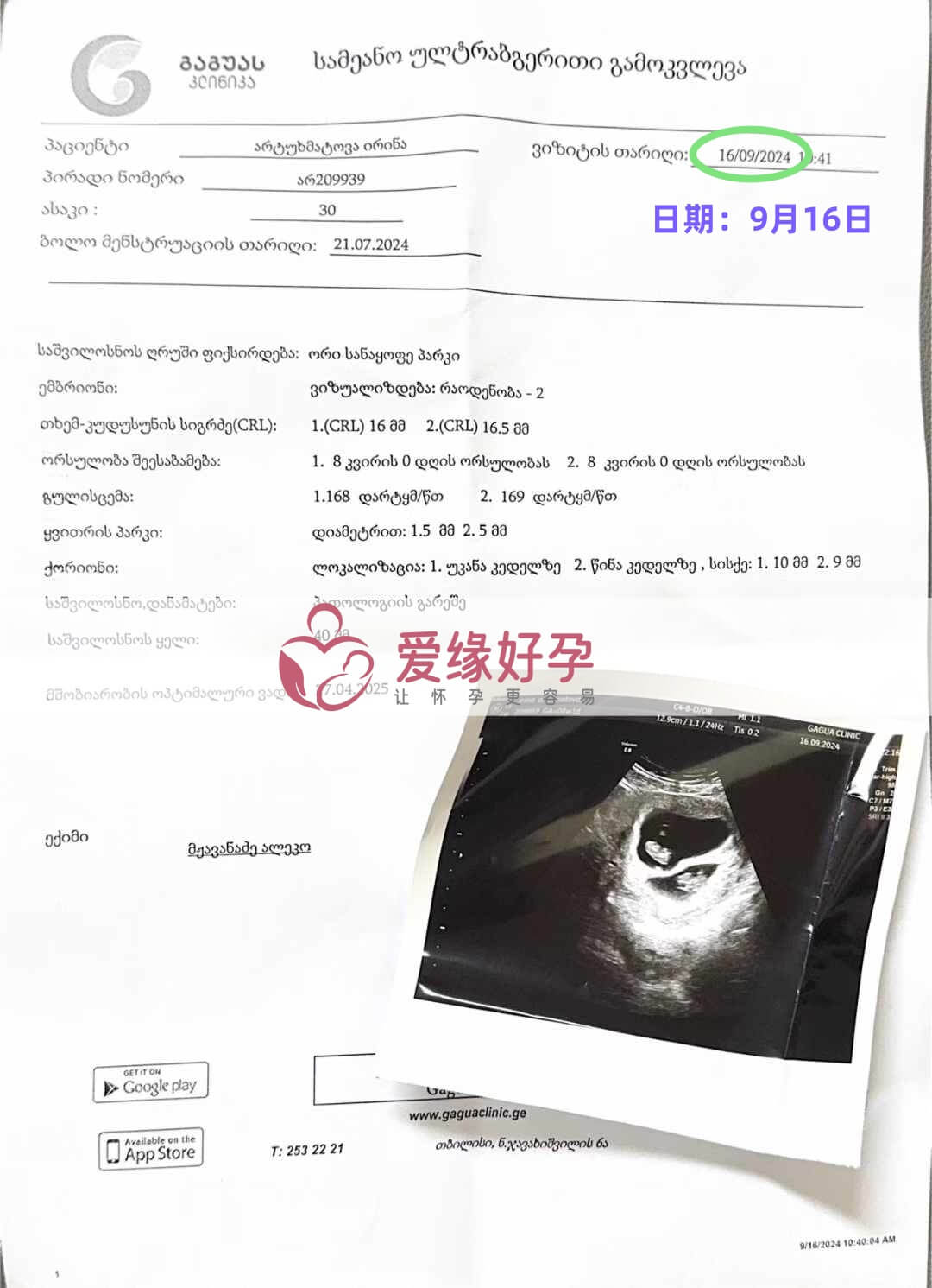 格鲁吉亚代孕代母孕8周产检顺利通过