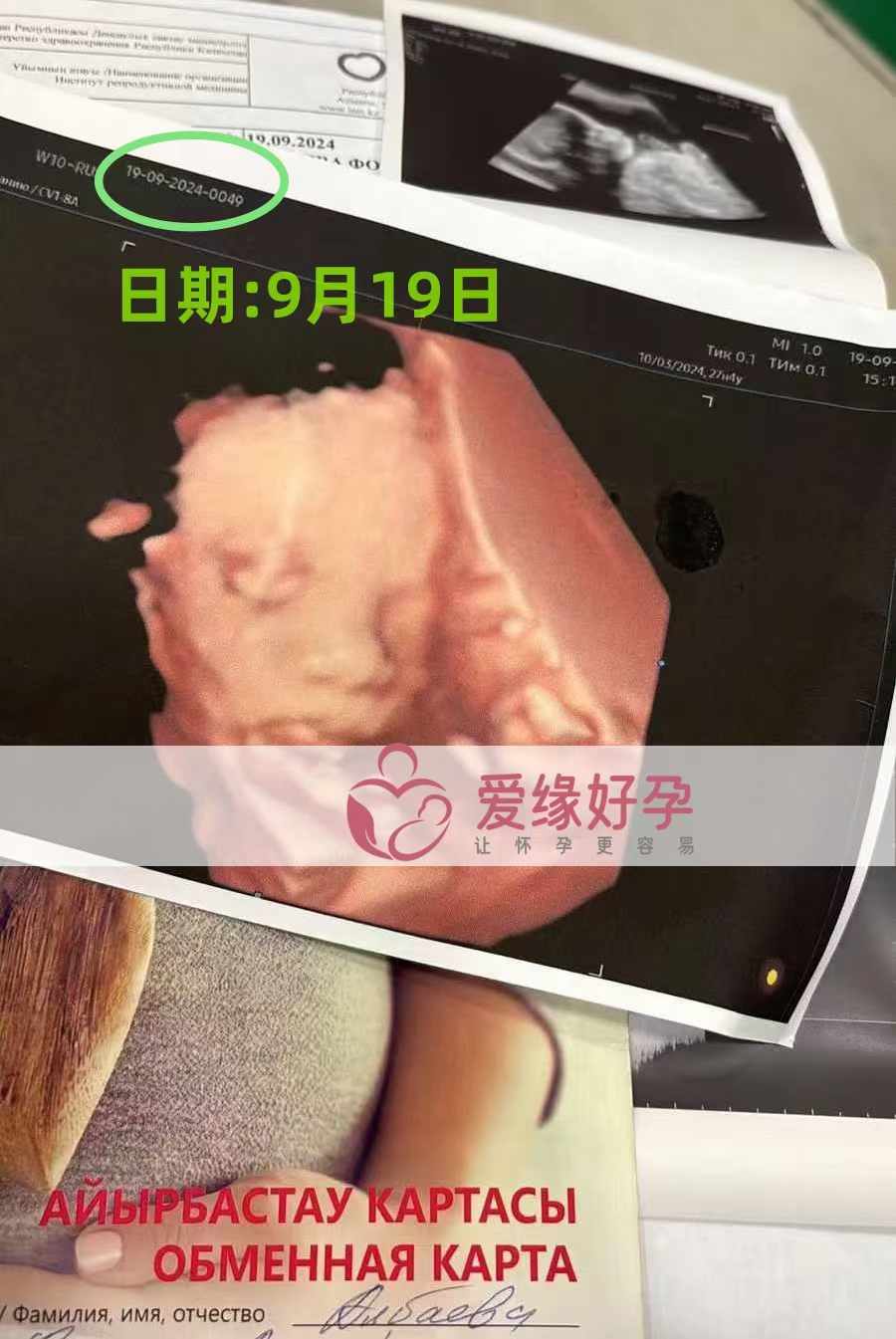 哈萨克斯坦代孕代母孕27周产检顺利通过！