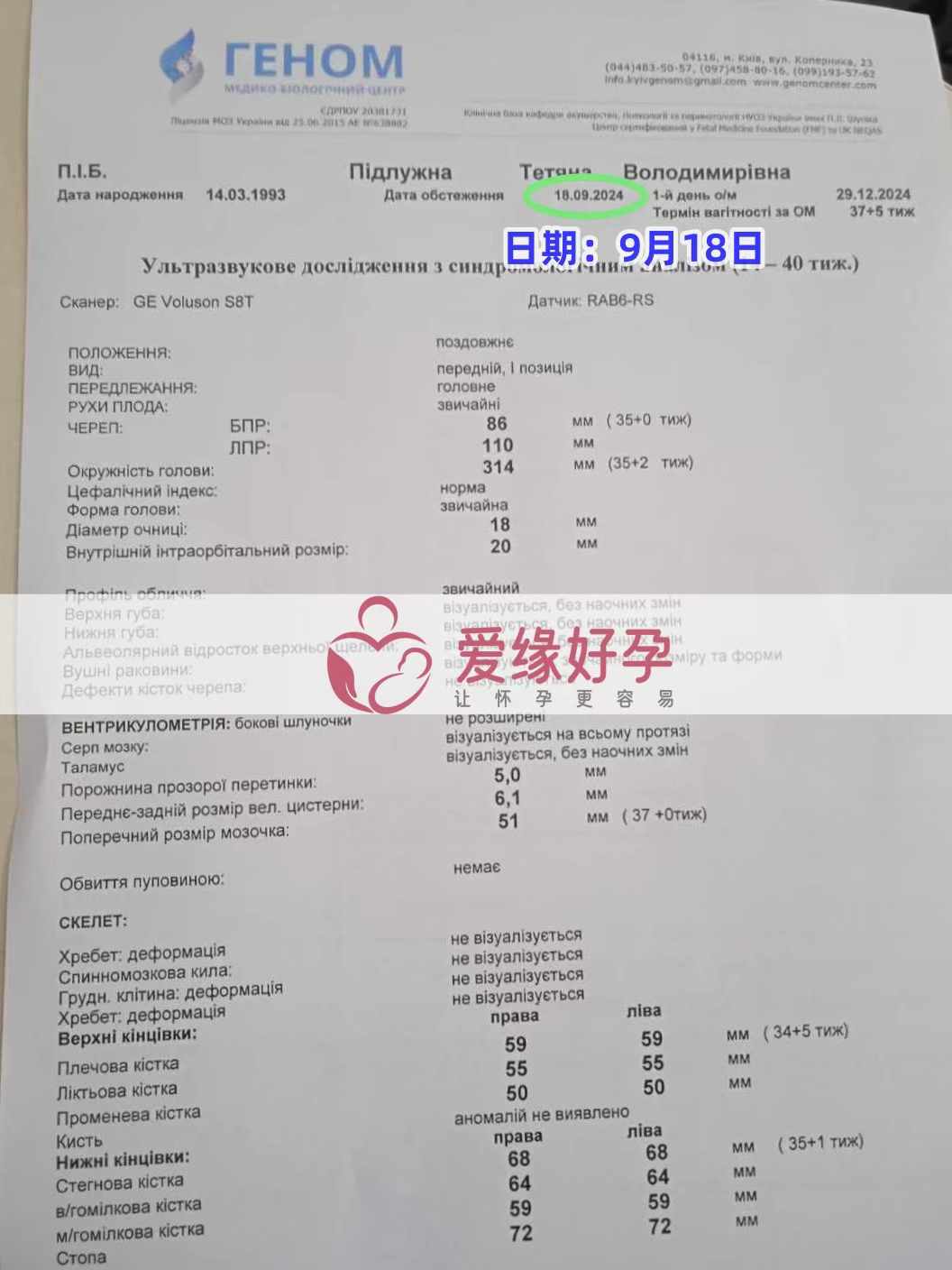 乌克兰代孕代母孕35周产检顺利通过！