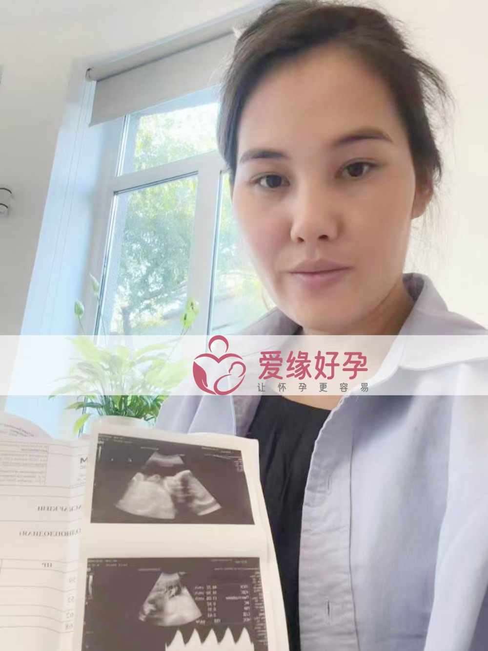 哈萨克斯坦代孕代母孕27周产检顺利通过！