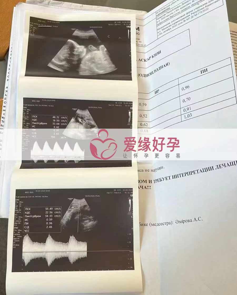 哈萨克斯坦代孕代母孕27周产检顺利通过！