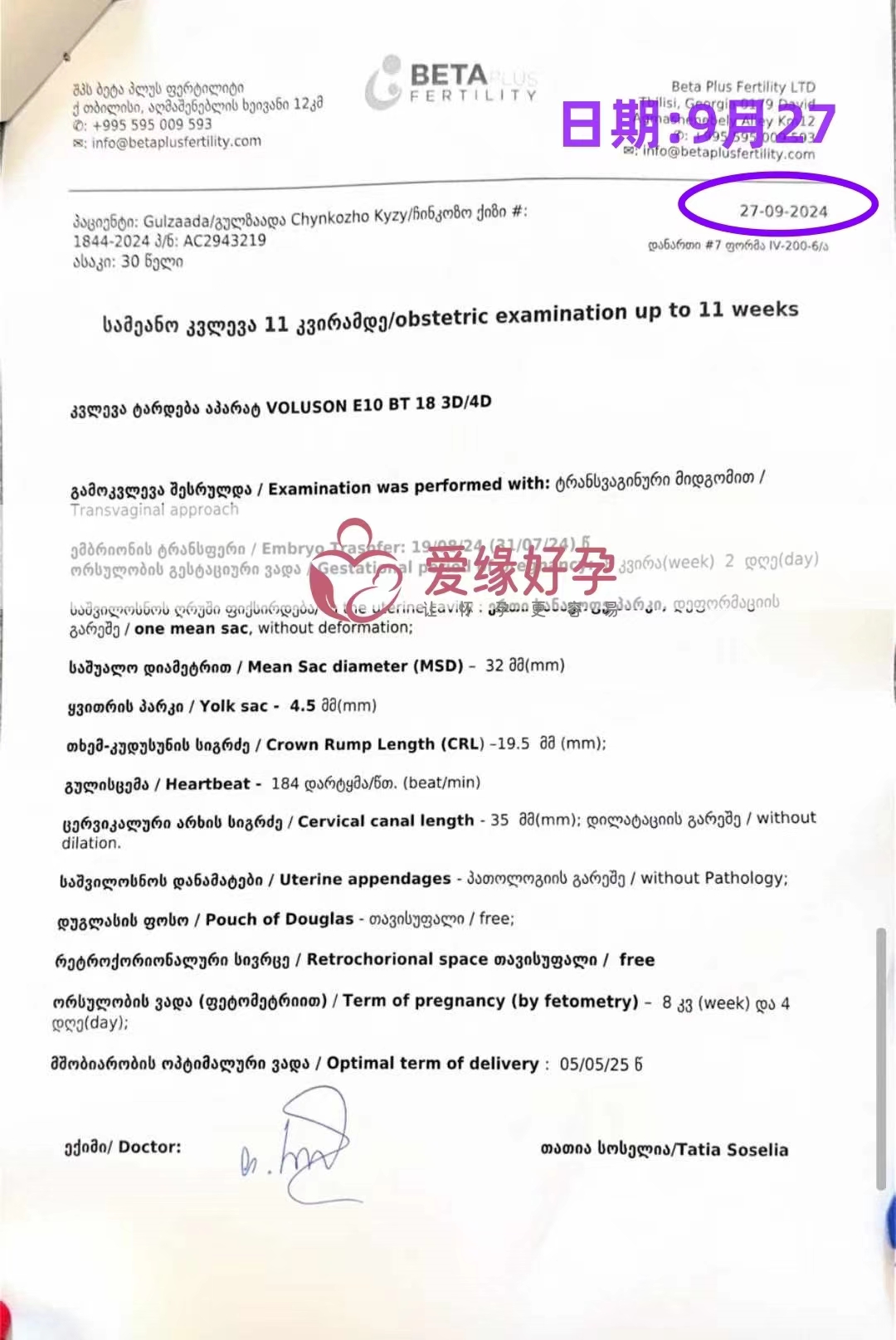 格鲁吉亚代孕代母孕8周产检顺利通过