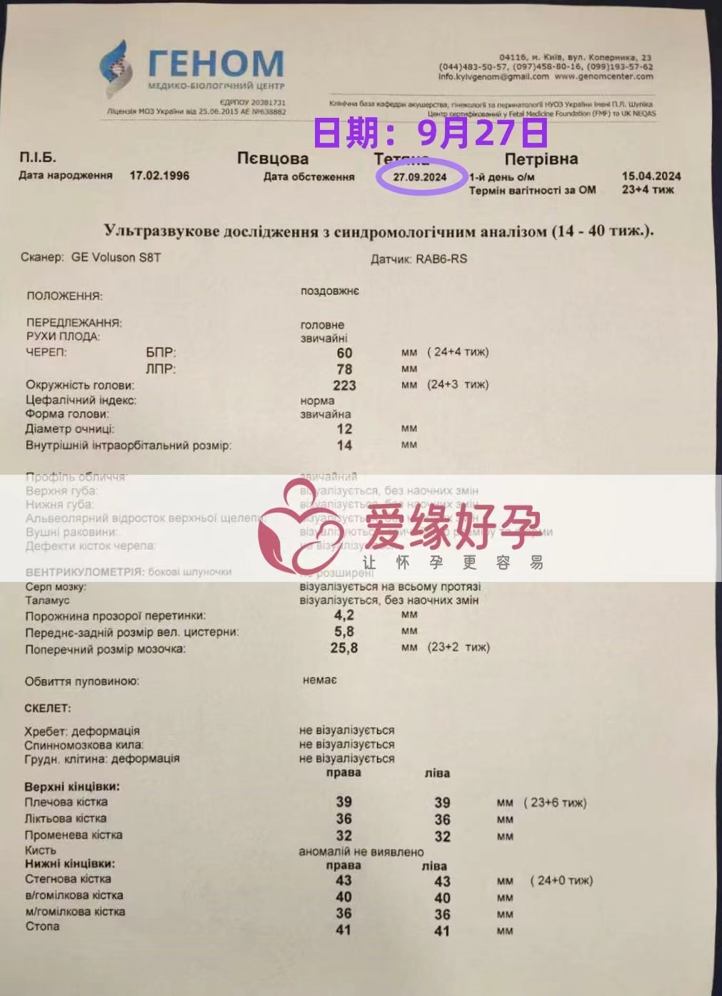 乌克兰代孕代母孕24周产检顺利通过