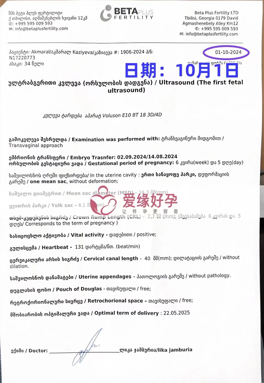 格鲁吉亚代孕代母孕6周产检顺利通过