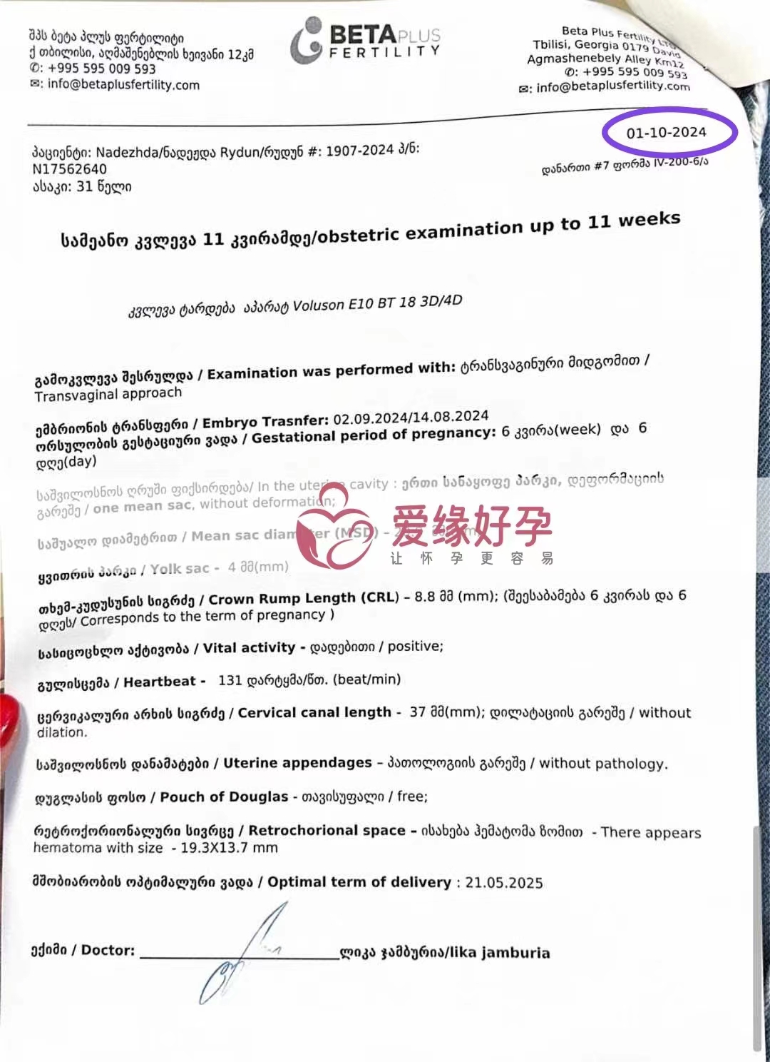 格鲁吉亚代孕代母孕6周产检顺利通过