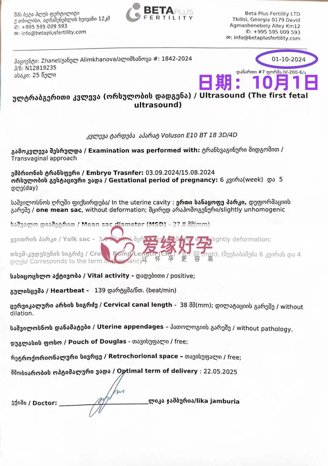 格鲁吉亚代孕代母孕6周产检顺利通过