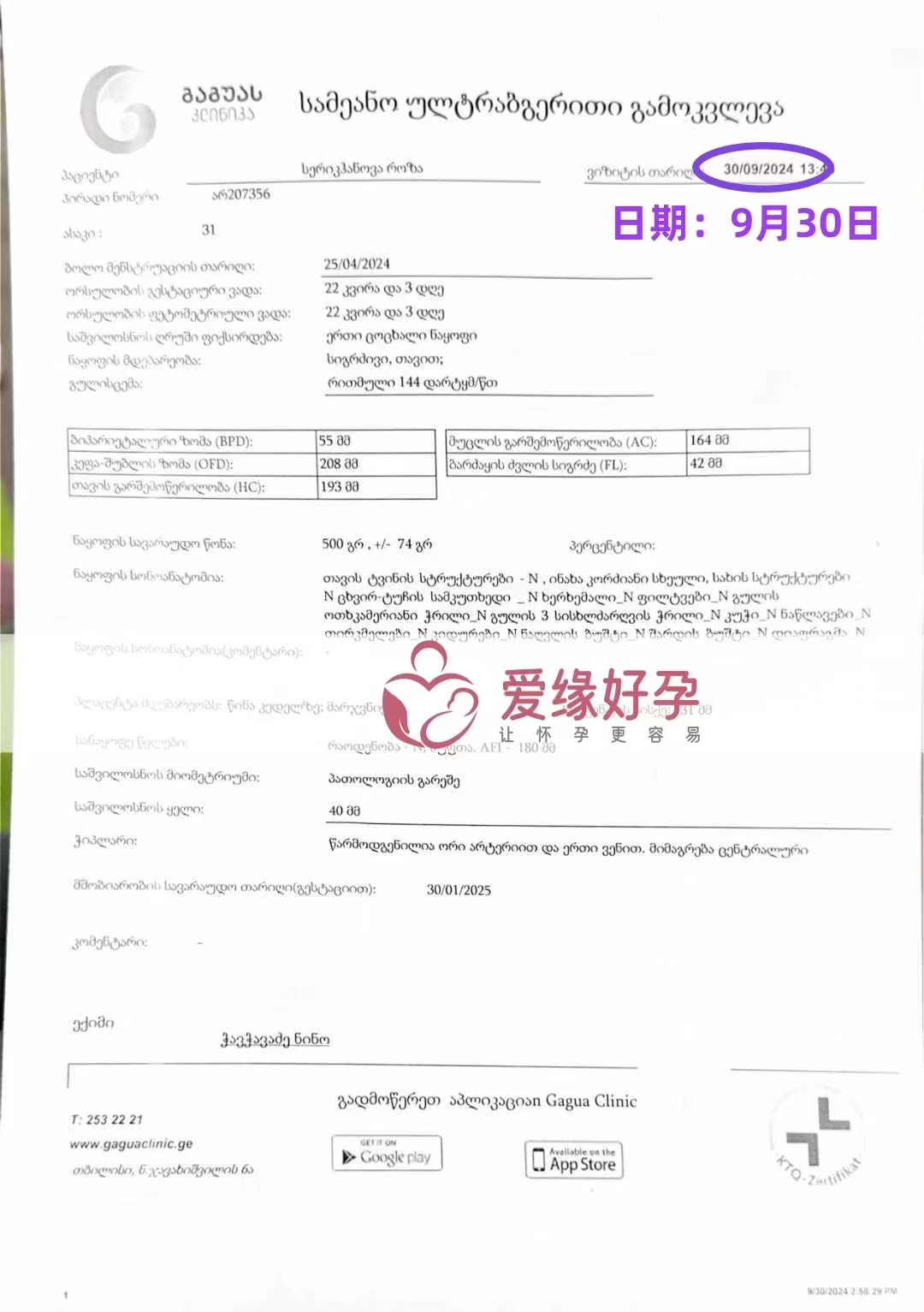 格鲁吉亚代孕代母孕22周产检顺利通过